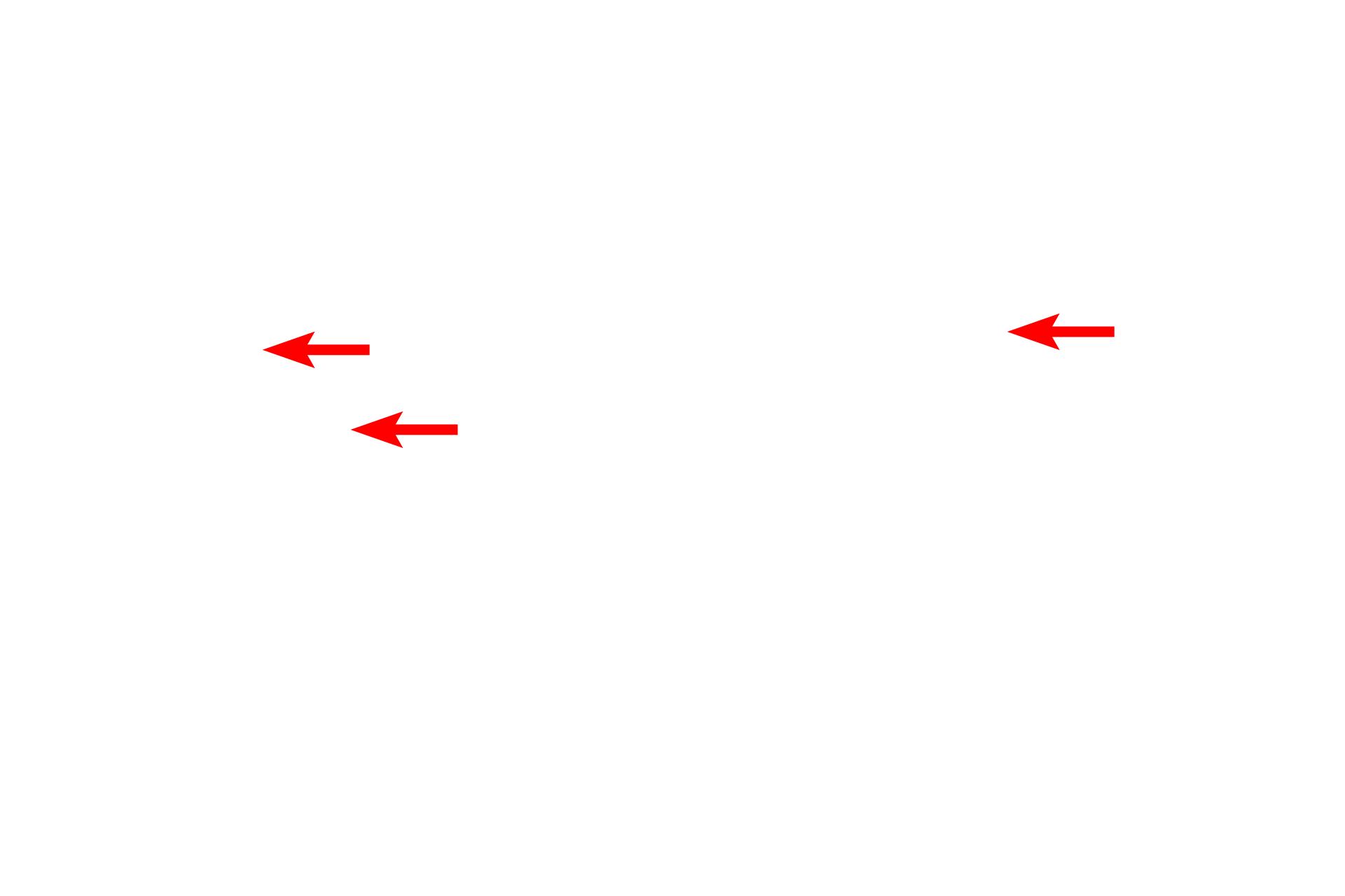 Apical dendrites <p>The shape of multipolar neurons can be highly variable and unique for specific regions of the brain.  Pyramidal neurons, seen here in the cerebral cortex, have pyramidal-shaped cell bodies and a thick apical dendrite.  Several lateral dendrites also extend from the base of the cell body, as does the axon.  Nuclei of glial cells (astrocytes and oligodendrocytes) are also visible. 400x</p>
