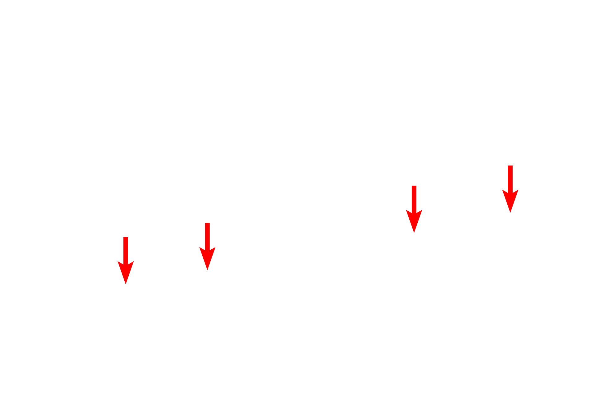 Lateral dendrites <p>The shape of multipolar neurons can be highly variable and unique for specific regions of the brain.  Pyramidal neurons, seen here in the cerebral cortex, have pyramidal-shaped cell bodies and a thick apical dendrite.  Several lateral dendrites also extend from the base of the cell body, as does the axon.  Nuclei of glial cells (astrocytes and oligodendrocytes) are also visible. 400x</p>
