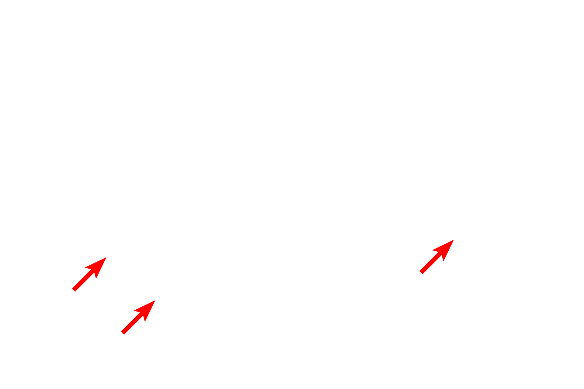 Axon <p>The shape of multipolar neurons can be highly variable and unique for specific regions of the brain.  Pyramidal neurons, seen here in the cerebral cortex, have pyramidal-shaped cell bodies and a thick apical dendrite.  Several lateral dendrites also extend from the base of the cell body, as does the axon.  Nuclei of glial cells (astrocytes and oligodendrocytes) are also visible. 400x</p>
