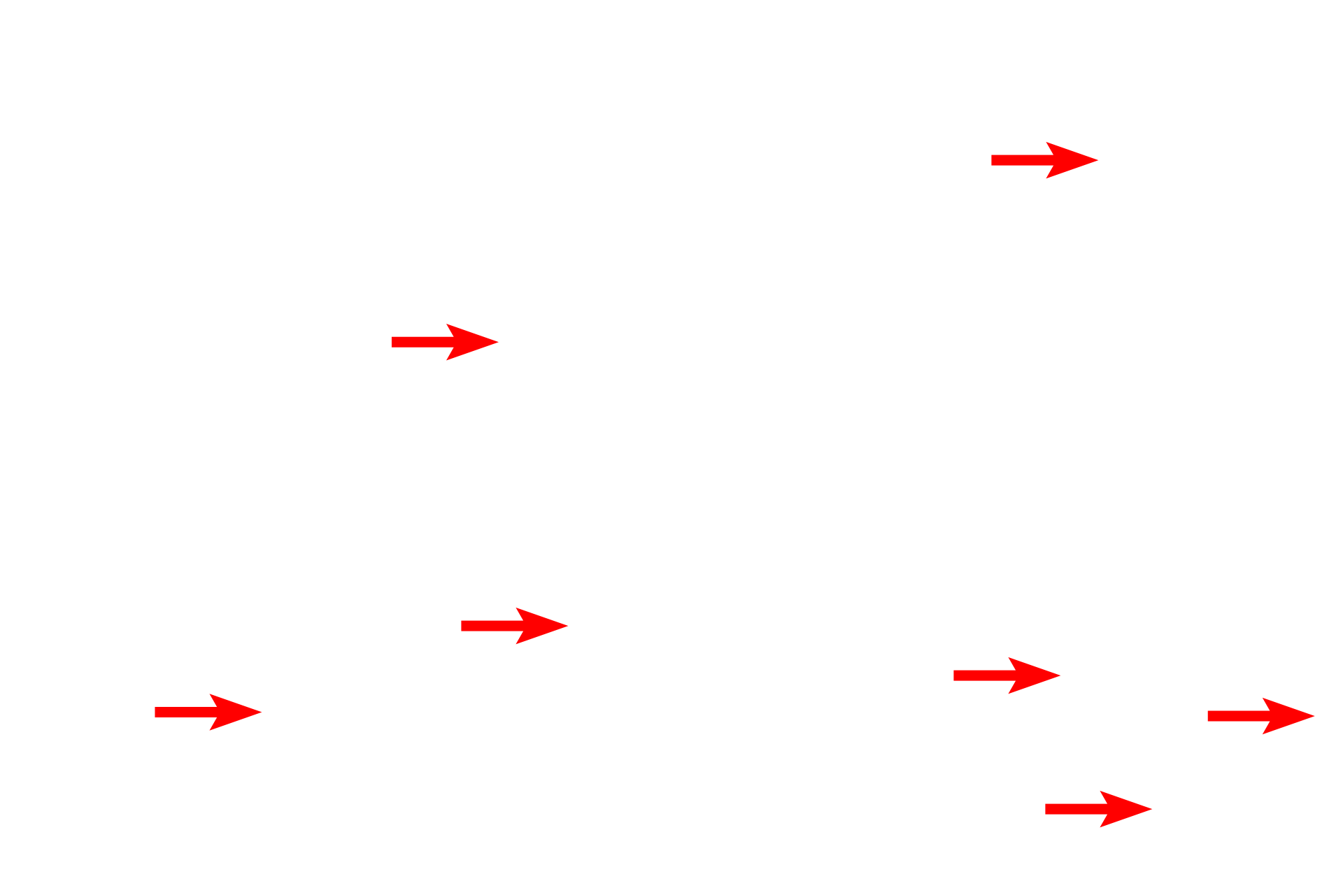 Myelinated axons <p>The shape of multipolar neurons can be highly variable and unique for specific regions of the brain.  Pyramidal neurons, seen here in the cerebral cortex, have pyramidal-shaped cell bodies and a thick apical dendrite.  Several lateral dendrites also extend from the base of the cell body, as does the axon.  Nuclei of glial cells (astrocytes and oligodendrocytes) are also visible. 400x</p>
