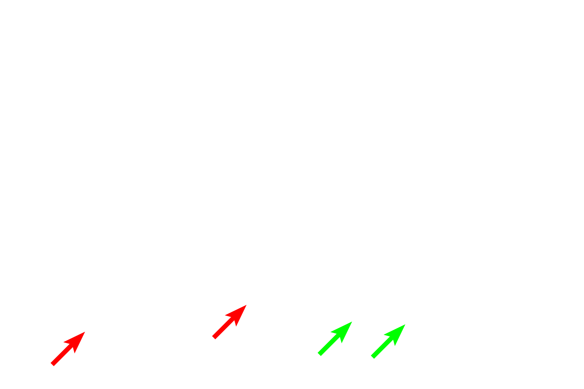 Purkinje cell body <p>Purkinje cells, located in the cerebellum, are another example of multipolar neurons with unique shapes. They possess an extensive, apical dendritic arborization with numerous dendritic spines (inset) for synaptic contact.  H & E stain (left), 400x; Golgi silver stain (right and inset) 400x, 1000x</p>
