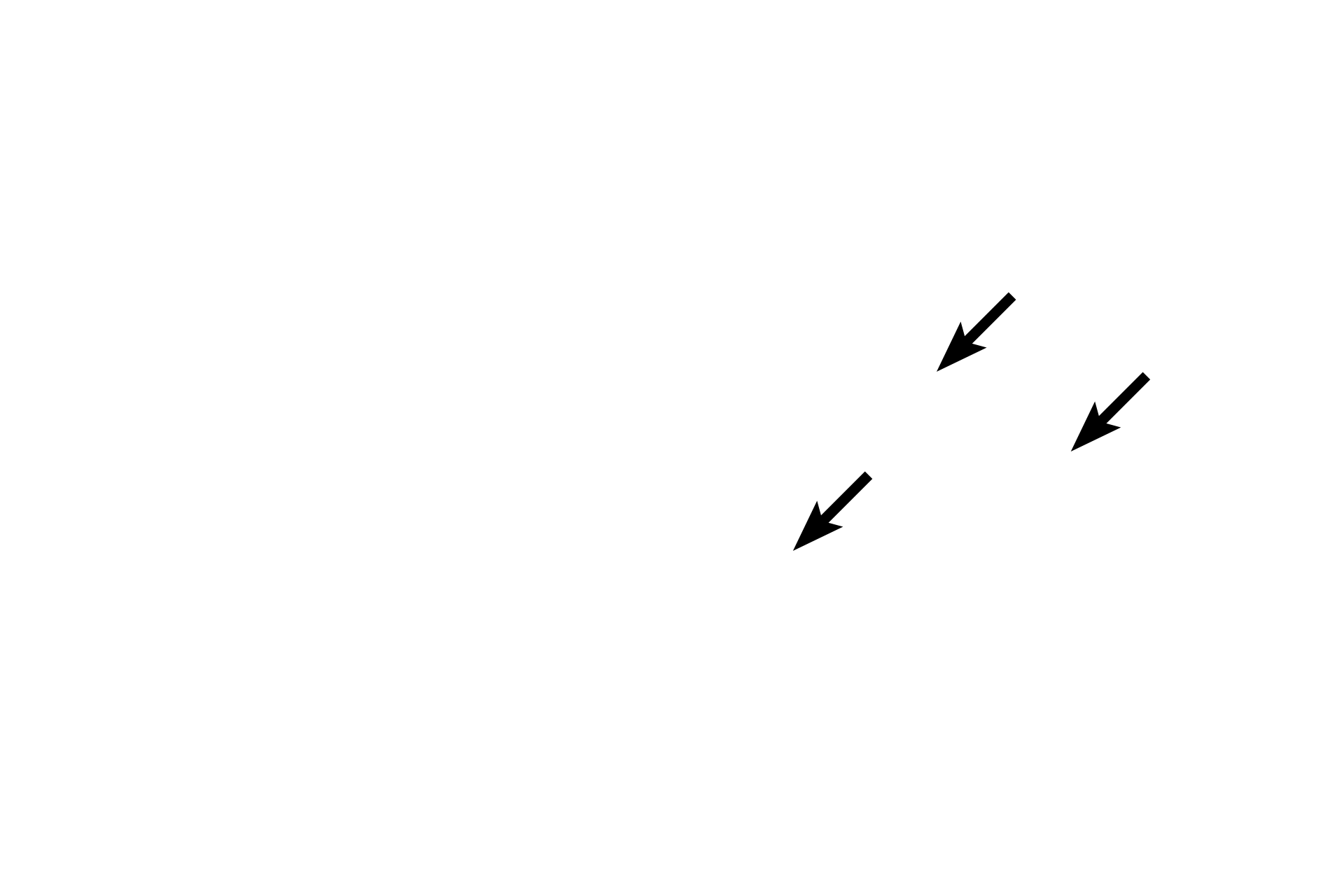 Neuronal cell bodies <p>The cell bodies of multipolar neurons can also be found in autonomic ganglia throughout the body as part of the autonomic nervous system.  This ganglion is a component of the parasympathetic division and contains multipolar, motor neurons.  The ganglion is located in the wall of the digestive tract, between layers of smooth muscle which it innervates.  Autonomic neurons generally have an eccentric nucleus and Nissl that forms a more delicate, lacy pattern compared with the more coarse arrangement seen in multipolar neurons in the central nervous system.  The other nuclei in the ganglion are those of Schwann cells.  400x.</p>
