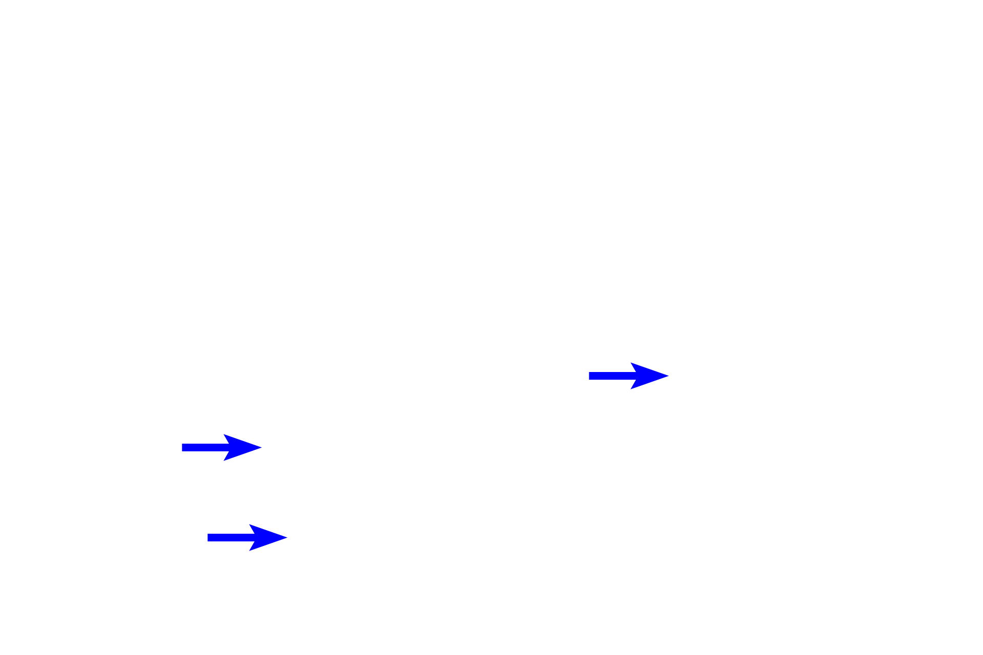  - Duct <p>This image shows apocrine and eccrine sweat glands in the axilla.  Apocrine sweat glands are large with a wide lumen and secrete a thick, protein-rich secretion by the merocrine mode.  These secretions acquire a distinctive odor by the action of bacteria on the skin surface.  The duct of an apocrine sweat gland empties into the hair follicle.  200x</p>
