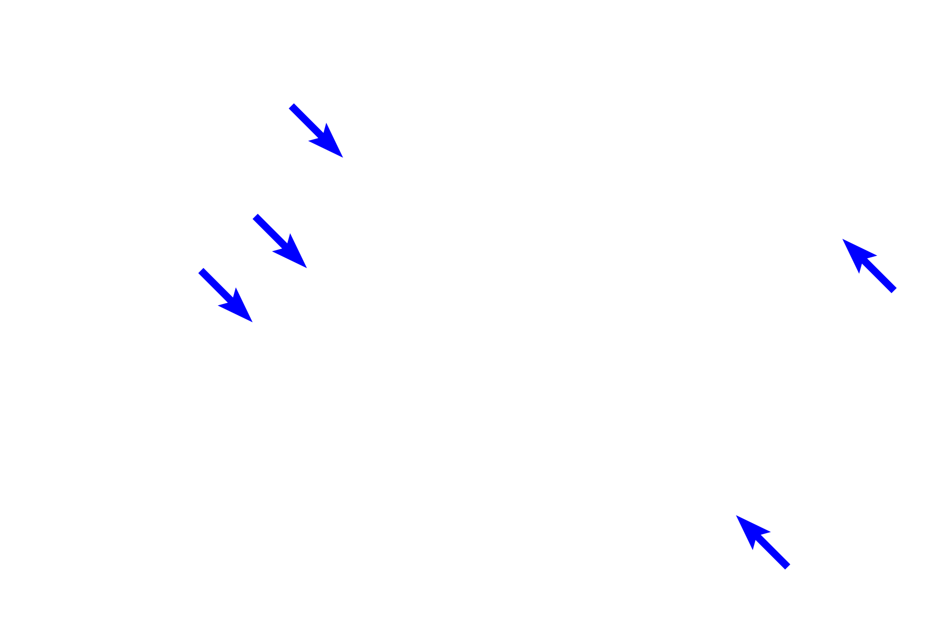  - Arrector pili muscle <p>The arrector pili muscle is band of smooth muscle anchored at one end in the papillary layer of the dermis and attached to the hair follicle at the other, in a specialized stem-cell niche called the follicular bulge.  Contraction of the arrector pili elevates the hair shaft and produces depressions on the skin surface called “goose flesh”. </p>
