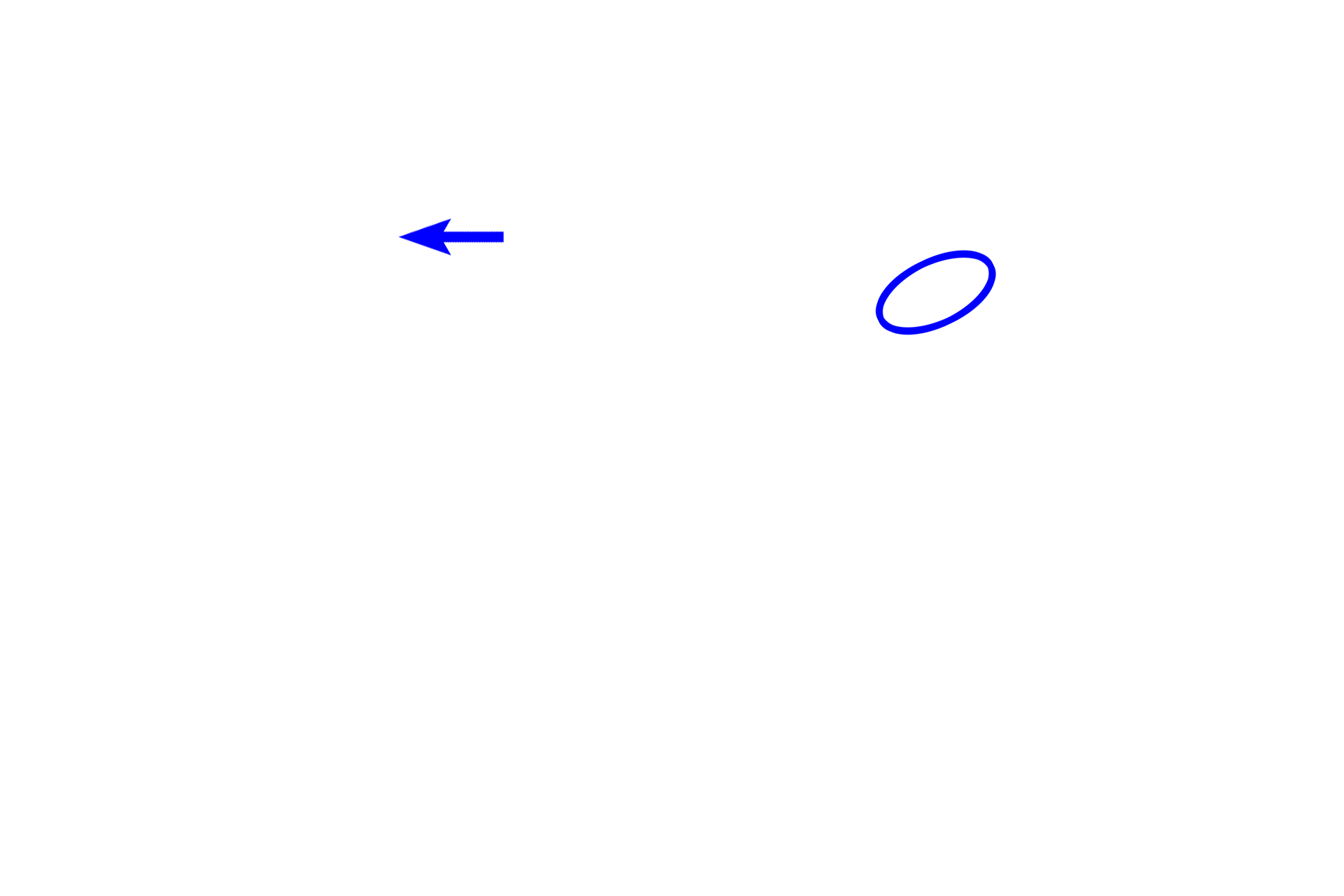  -- Duct <p>These images show a hair follicle with its associated sebaceous gland, collectively referred to as a pilosebaceous unit.  Sebaceous glands are normally associated with hair follicles and their secretory product, called sebum, is released onto the hair shaft in follicle. 100x, 400x</p>
