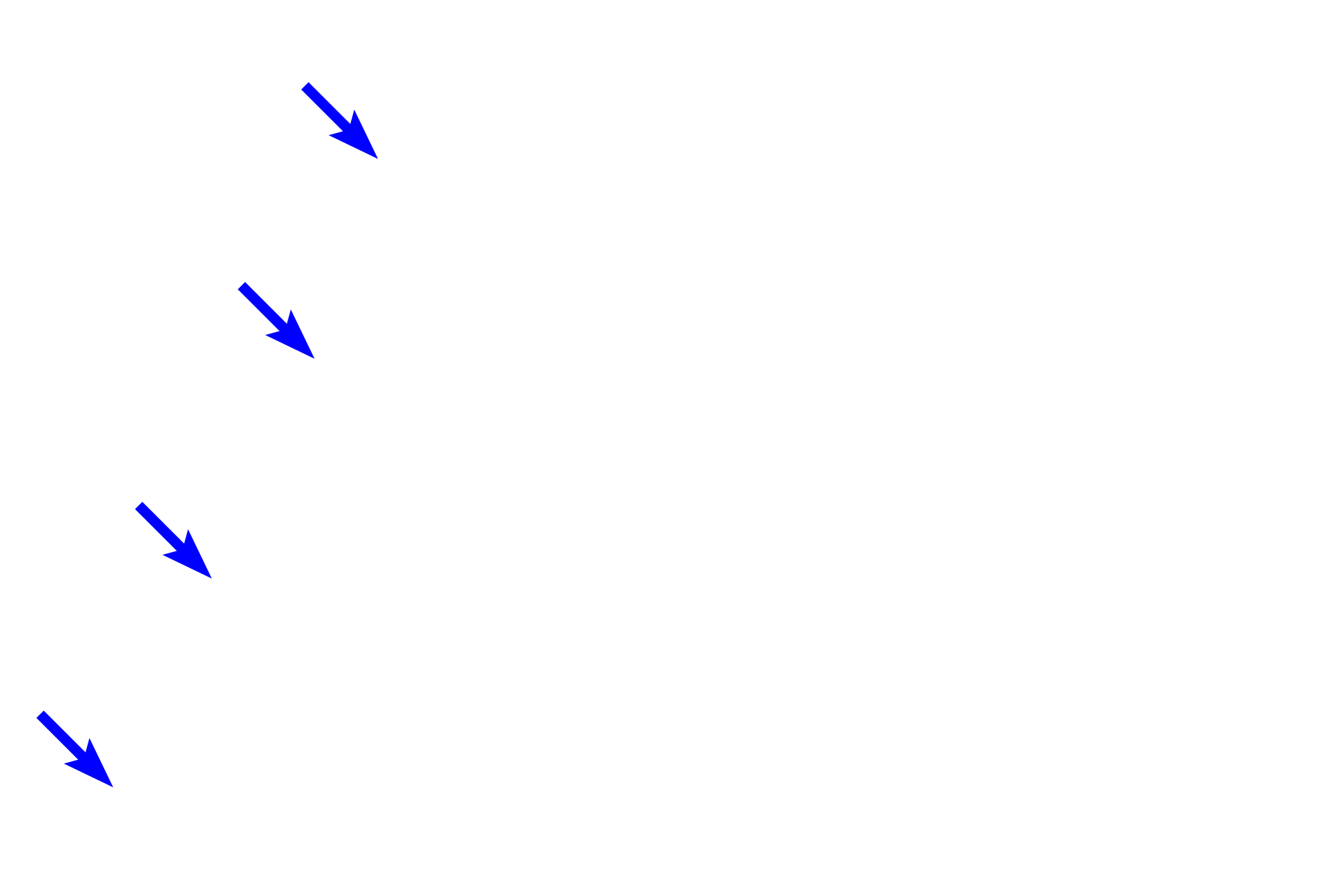  - Hair follicle <p>These images show a hair follicle with its associated sebaceous gland, collectively referred to as a pilosebaceous unit.  Sebaceous glands are normally associated with hair follicles and their secretory product, called sebum, is released onto the hair shaft in follicle. 100x, 400x</p>
