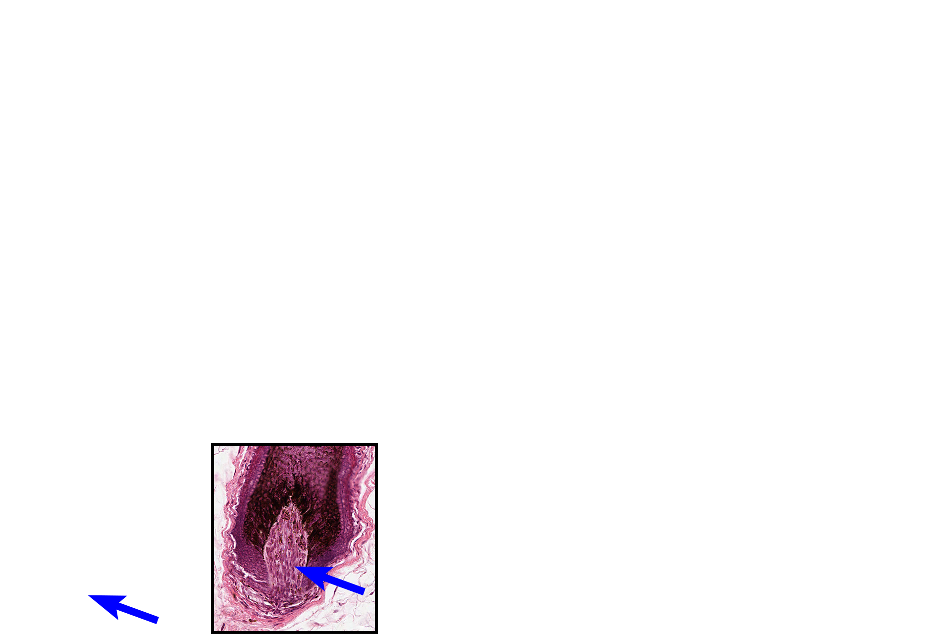  -- Papilla > <p>The base of the bulb is invaginated by the dermal papilla consisting of a tuft of vascularized loose connective tissue that maintains the follicle. </p>
