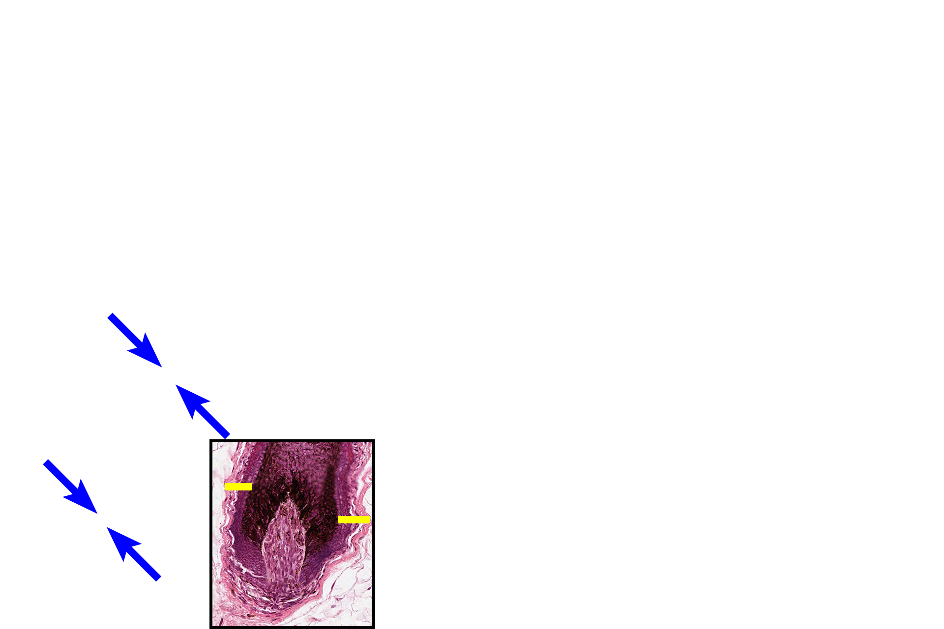  -- Follicle sheath > <p>The follicle sheath is a multilayered sleeve that surrounds the hair shaft. </p>
