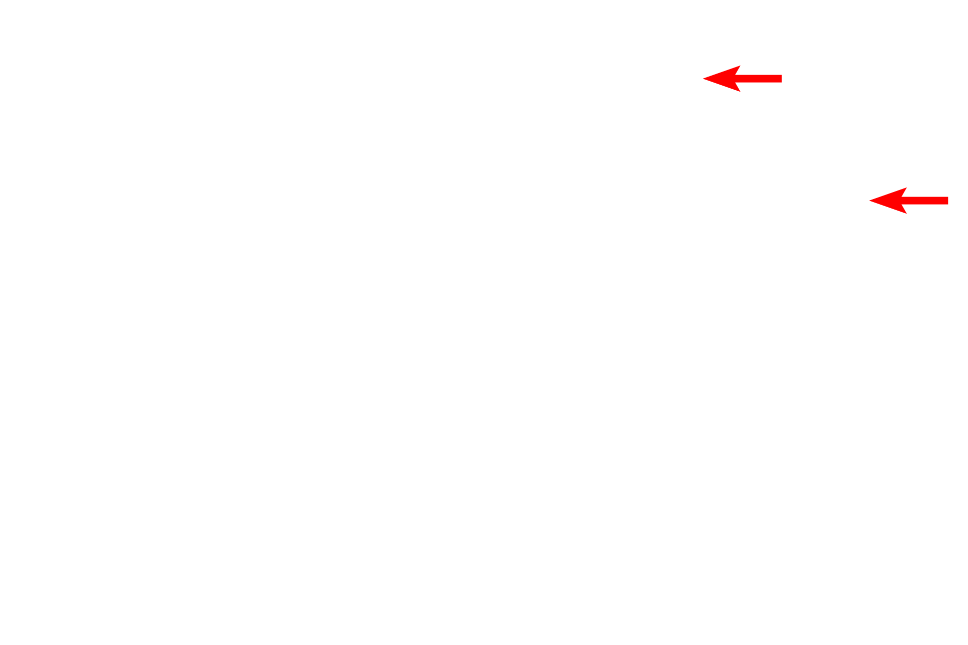  - Stratum granulosum <p>The epidermis is a stratified squamous keratinized epithelium composed mostly of keratinocytes arranged in multiple strata.  Cell proliferation, occurring mostly in the basal layer, pushes cells upward, undergoing keratinization and cornification to produce flattened, scale-like cells that are shed from the surface.  This epithelium is specialized to provide protection against physical trauma and desiccation, and presents a barrier to infectious agents. Toluidine blue stain, 1000x</p>
