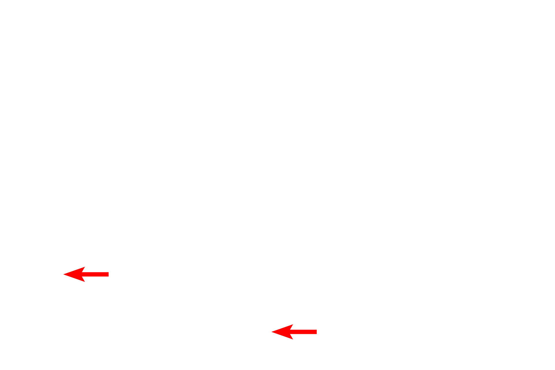  - Melanocytes <p>The epidermis is a stratified squamous keratinized epithelium composed mostly of keratinocytes arranged in multiple strata.  Cell proliferation, occurring mostly in the basal layer, pushes cells upward, undergoing keratinization and cornification to produce flattened, scale-like cells that are shed from the surface.  This epithelium is specialized to provide protection against physical trauma and desiccation, and presents a barrier to infectious agents. Toluidine blue stain, 1000x</p>
