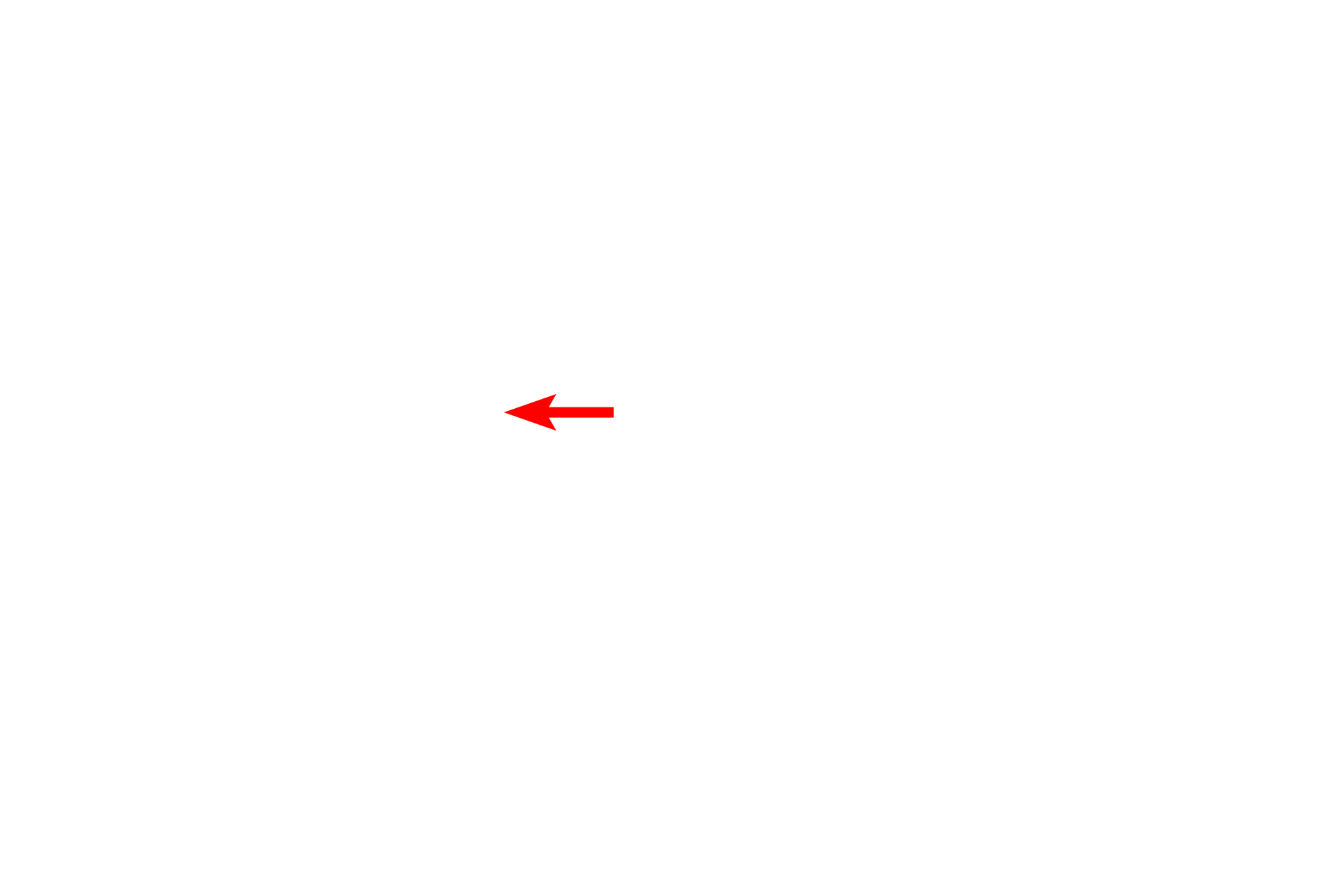  - Langherhans cell <p>The epidermis is a stratified squamous keratinized epithelium composed mostly of keratinocytes arranged in multiple strata.  Cell proliferation, occurring mostly in the basal layer, pushes cells upward, undergoing keratinization and cornification to produce flattened, scale-like cells that are shed from the surface.  This epithelium is specialized to provide protection against physical trauma and desiccation, and presents a barrier to infectious agents. Toluidine blue stain, 1000x</p>
