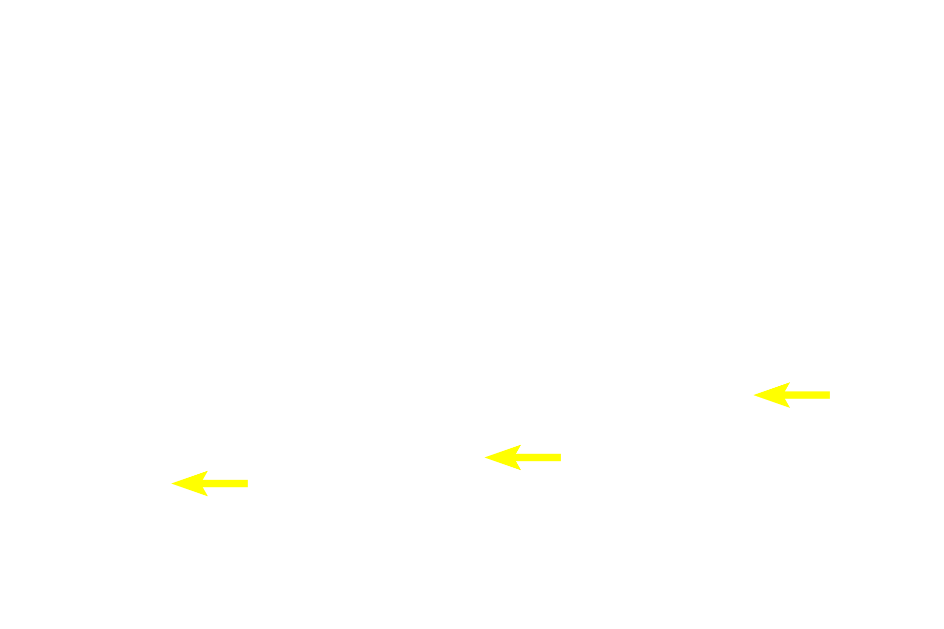 Stratum basale <p>A second cell type present in the stratum basale is the melanocyte, which often appear to have a clear, halo-like cytoplasm around a heterochromatic nucleus.  Melanocytes synthesize melanin pigment which they package it into melanosomes that are transferred to keratinocytes, imparting an overall brownish color to the stratum basale.  Melanin absorbs ultraviolet light thereby protecting the DNA in the stratum basal cells.  Melanocytes have a different embryological origin from keratinocytes.  Also visible in the epidermis are migrating macrophages called Langerhans cells.  400x</p>
