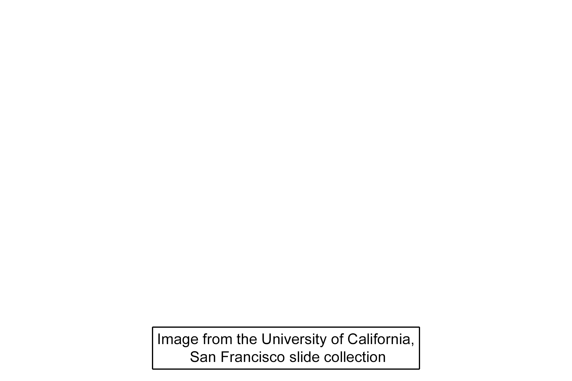 Image source >  <p>This was taken of a slide in the University of California, San Francisco slide collection.</p>
