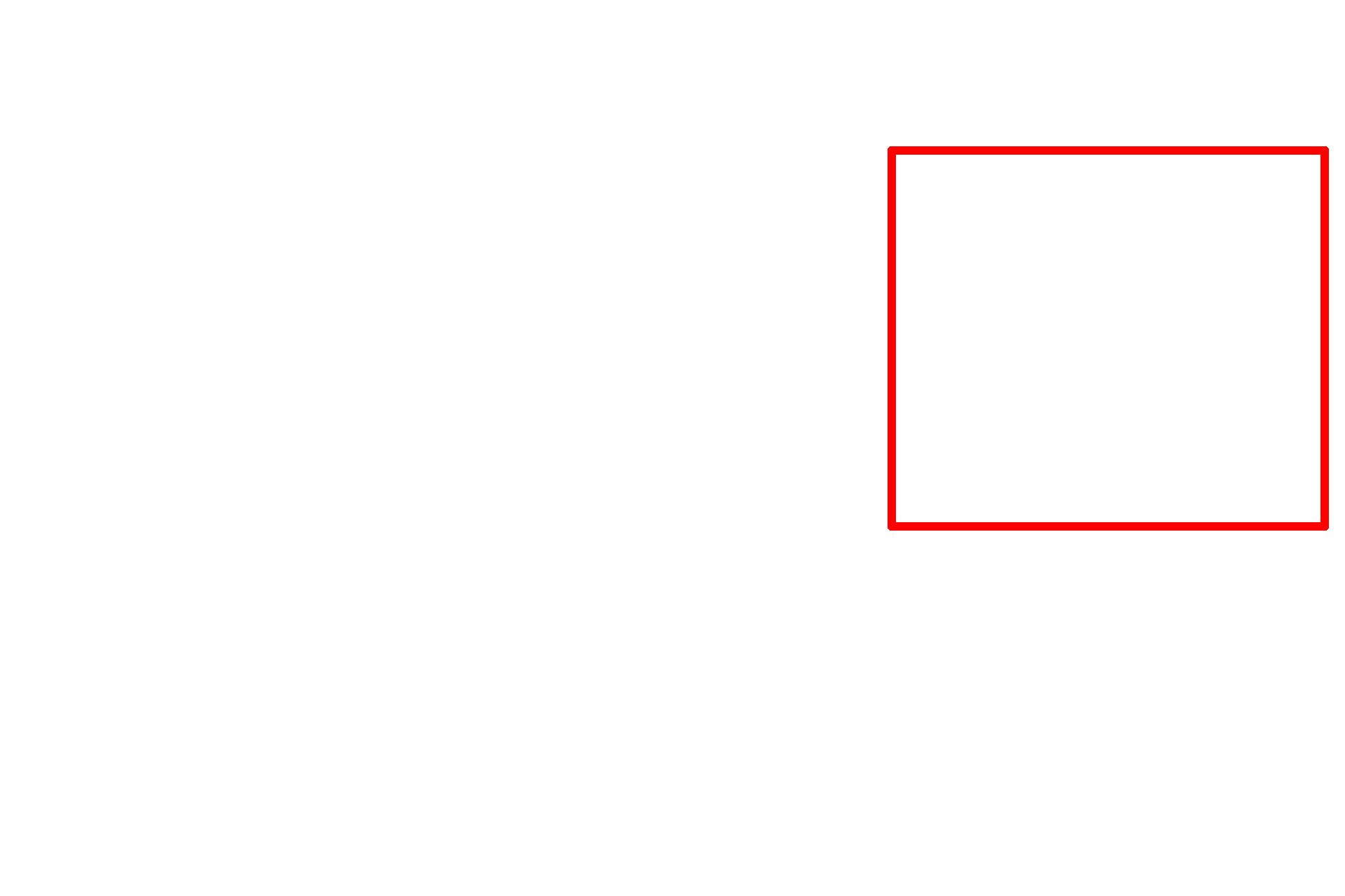 Sectioning > <p>The third step is sectioning, which produces tissue slices sufficiently thin to allow transmission of the illumination source through the section.  For light microscopy (LM), the illumination is white light; for electron microscopy (EM), the illumination is a beam of electrons.  Tissue is sectioned on a microtome and sections are collected either on glass slides (LM) or mesh grids (EM).  Paraffin sections for LM range from 5 to 20 microns in thickness; epoxy sections for EM range from 30 to 60 nanometers in thickness.</p>
