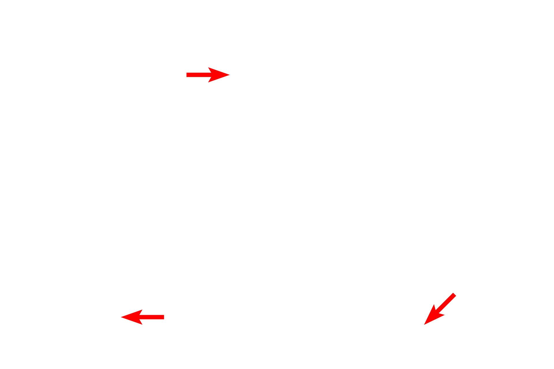 Viewing screen > <p>A viewable image is produced on a phosphorescent screen.  The final image is viewed on the screen with binocular viewer.  Images are permanently captured either digitally or on photographic film.</p>
