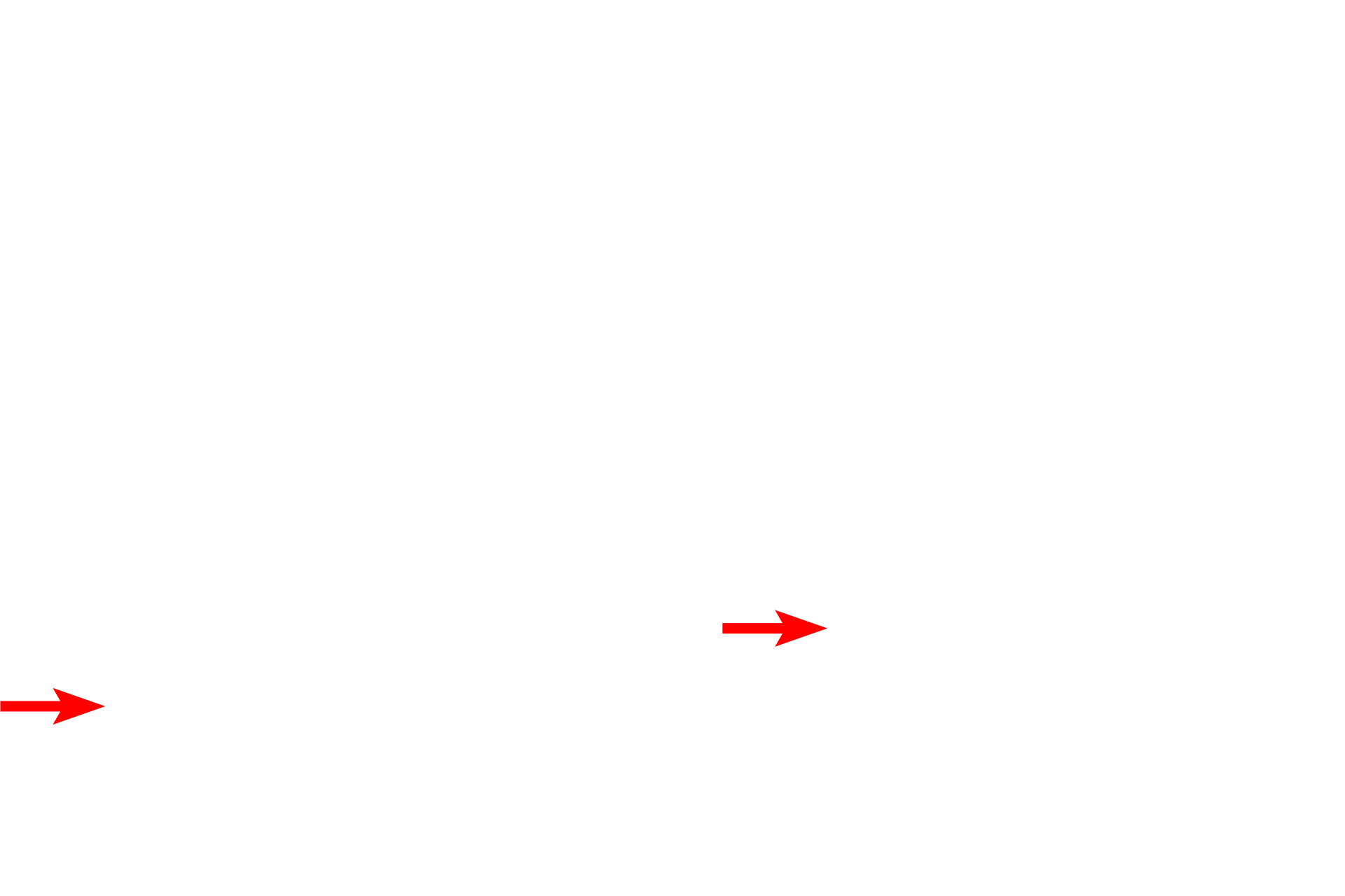  - Binocular viewer <p>A viewable image is produced on a phosphorescent screen.  The final image is viewed on the screen with binocular viewer.  Images are permanently captured either digitally or on photographic film.</p>
