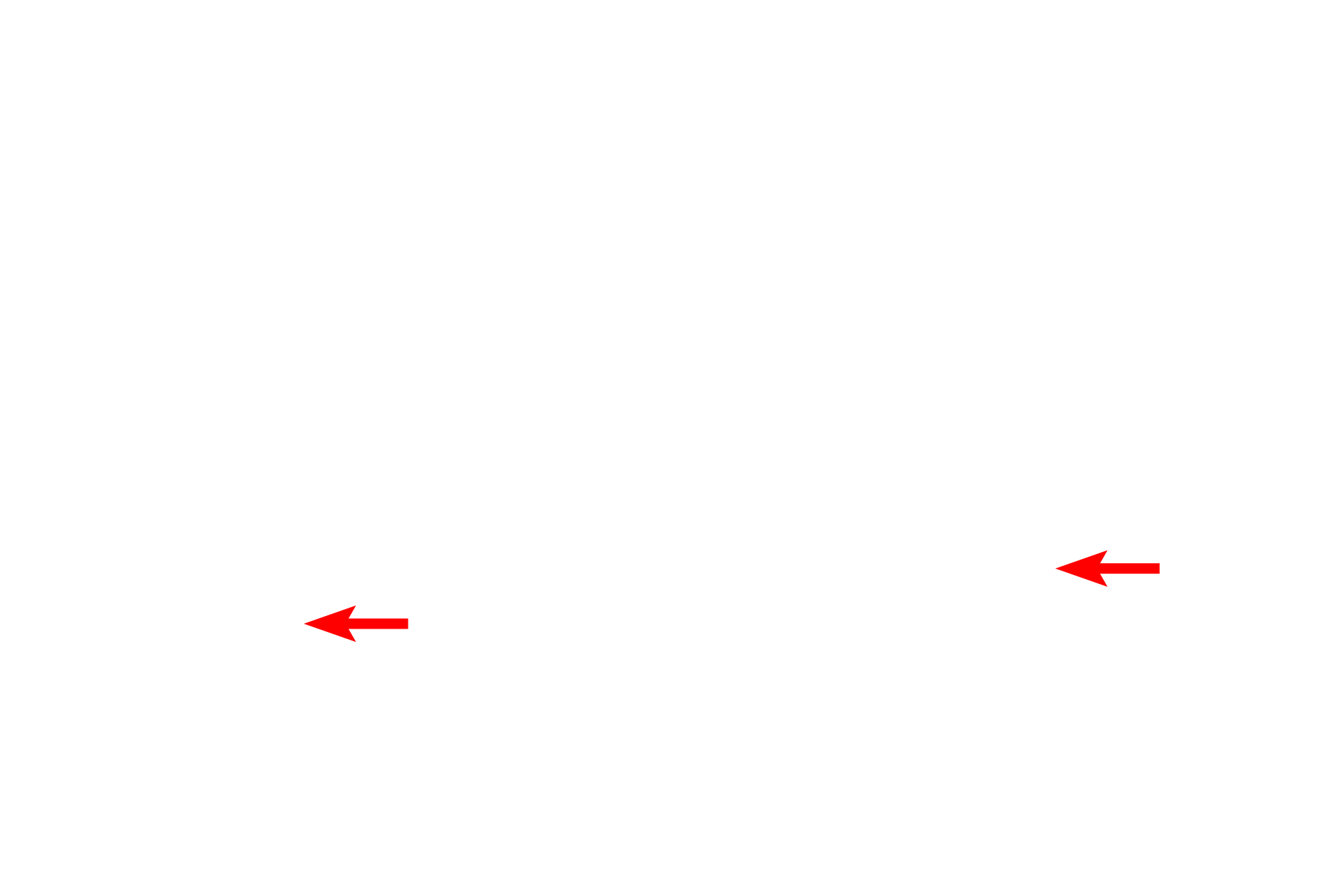  - Projector lens > <p>The projector lens adds additional magnification and projects the final image onto a phosphorescent screen for viewing.  The projector lens is analogous to the eyepiece in a light microscope.</p>
