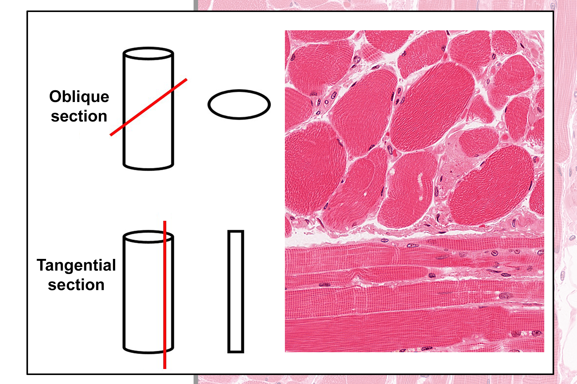 Additional section planes >  <p>While structures are often depicted in either cross or longitudinal section, most tissue components are sectioned either obliquely or tangentially, thus complicating the interpretation of their three-dimensional shape.</p>
