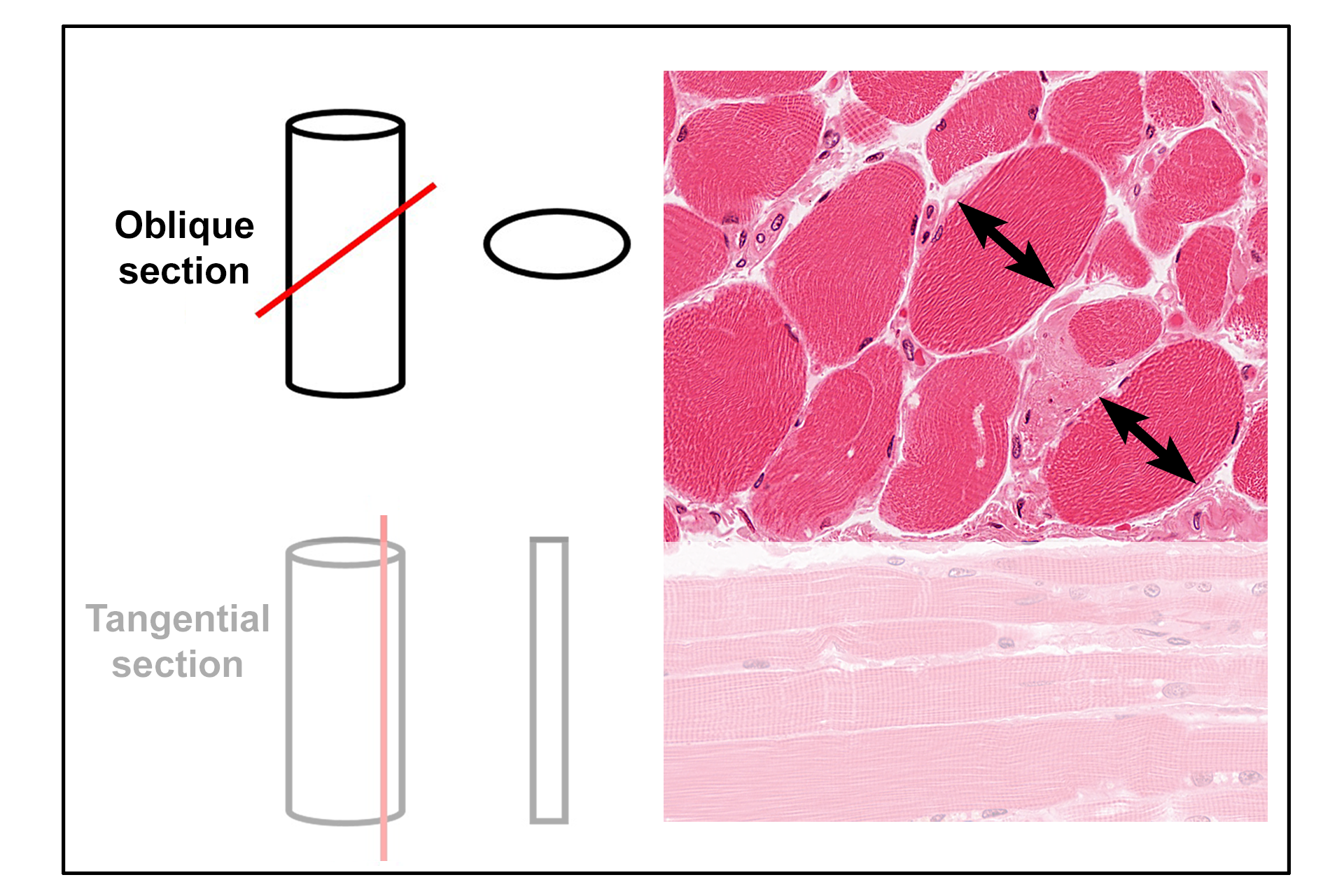  - Oblique section >  <p>An oblique section is a slice through a structure in a plane that is other than parallel or perpendicular to the longest axis of the structure. In this example, a cylindrical structure will appear oval in section. Examples of obliquely-sectioned skeletal muscle fibers are indicated.</p>
