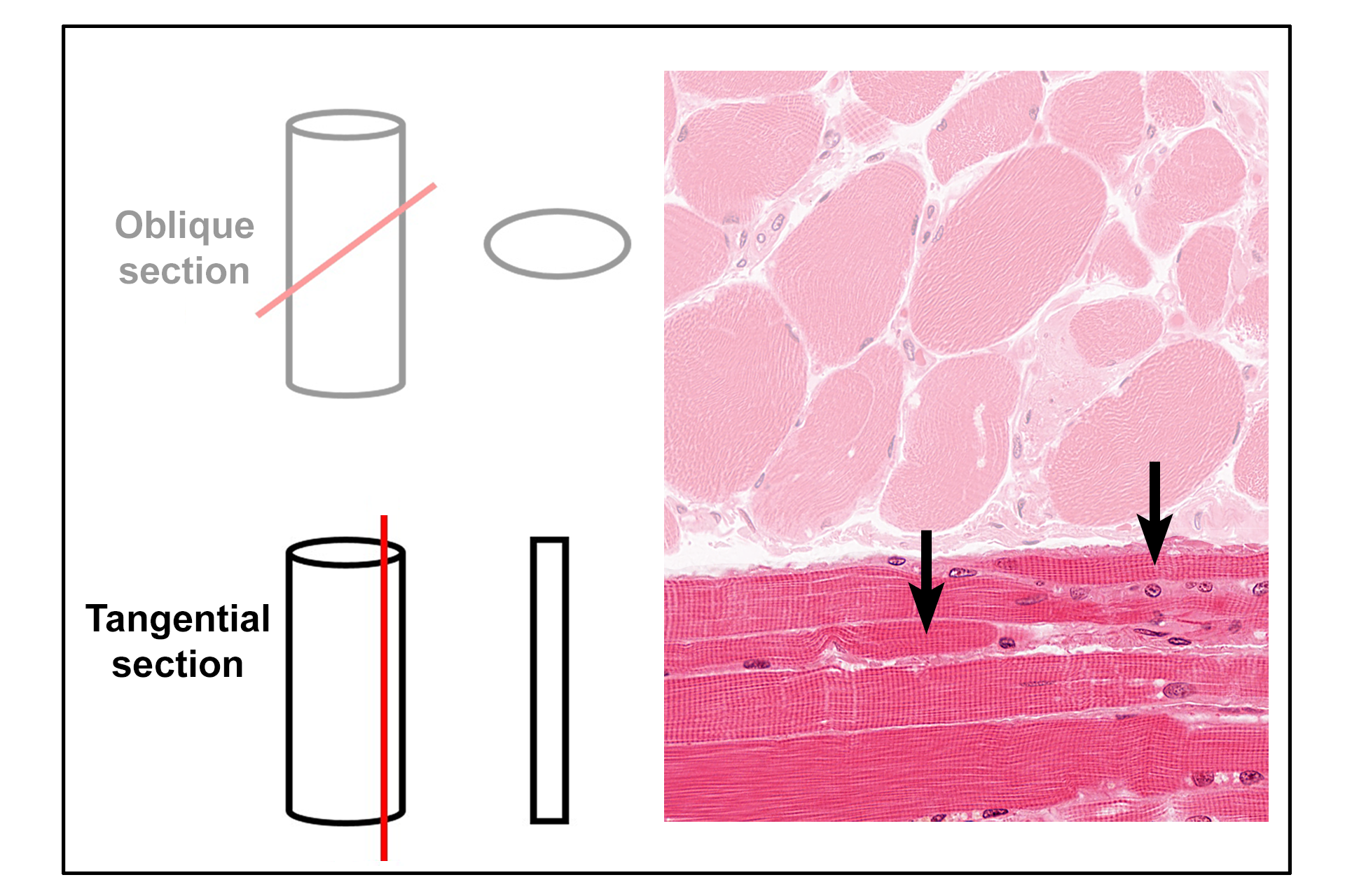  - Tangential section > <p>A tangential section is a slice that only superficially cuts through the surface of a structure. In this example, a broad cylindrical structure will appear much thinner in section. Examples of tangentially-sectioned skeletal muscle fibers are indicated.</p>
