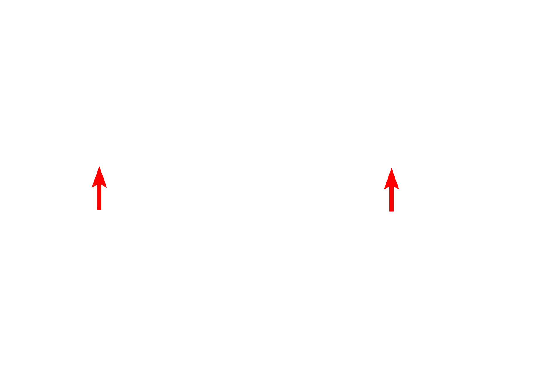 Tissue <p>After fixation and embedding, tissues are sectioned. For paraffin-embedded tissue, sectioning is usually performed on a rotary microtome, such as those pictured here. Tissue embedded in paraffin, referred to as the tissue block, is secured in a holder attached to a moveable arm of the microtome. For LM, section thickness is generally between 5 to 20 microns.</p>
