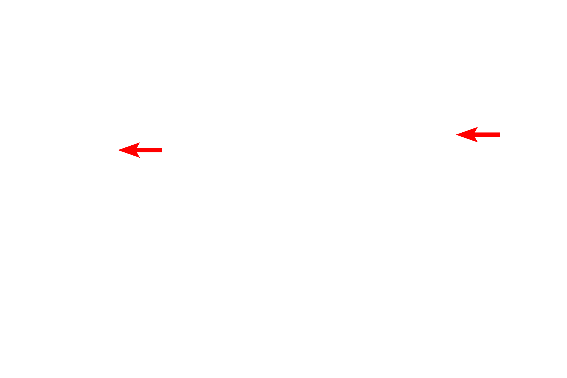 Tissue block holder <p>After fixation and embedding, tissues are sectioned. For paraffin-embedded tissue, sectioning is usually performed on a rotary microtome, such as those pictured here. Tissue embedded in paraffin, referred to as the tissue block, is secured in a holder attached to a moveable arm of the microtome. For LM, section thickness is generally between 5 to 20 microns.</p>
