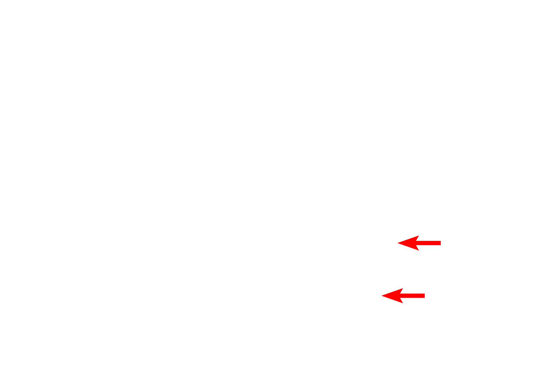 Sections > <p>As sections are generated, they form a ribbon. Sections are then collected and placed on glass slides for staining.</p>

