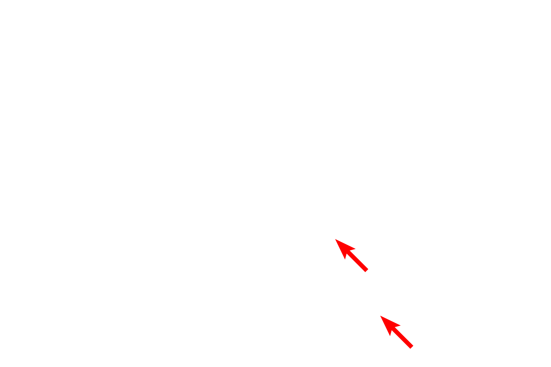 Epoxy resin <p>Tissue is routinely embedded in epoxy resin which provides the additional support needed for producing thin sections. Tissue samples for electron microscopy are much smaller in size than those used for light microscopy. The tissue block, is secured to the moveable arm of the ultramicrotome that moves past the knife with each successive rotation of the handwheel. For an ultramicrotome, the handwheel is generally motor-driven.</p>
