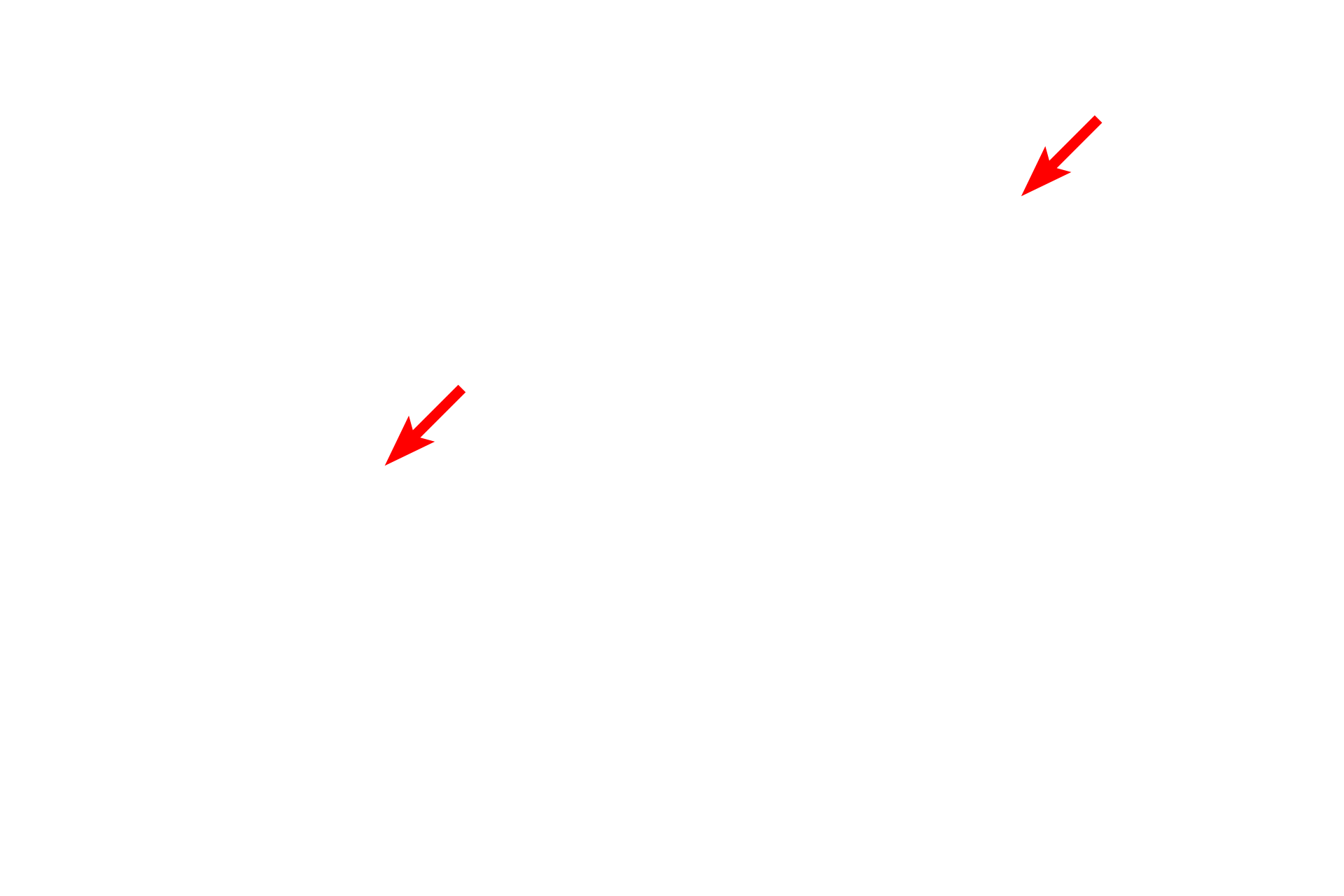 Tissue block holder <p>Tissue is routinely embedded in epoxy resin which provides the additional support needed for producing thin sections. Tissue samples for electron microscopy are much smaller in size than those used for light microscopy. The tissue block, is secured to the moveable arm of the ultramicrotome that moves past the knife with each successive rotation of the handwheel. For an ultramicrotome, the handwheel is generally motor-driven.</p>
