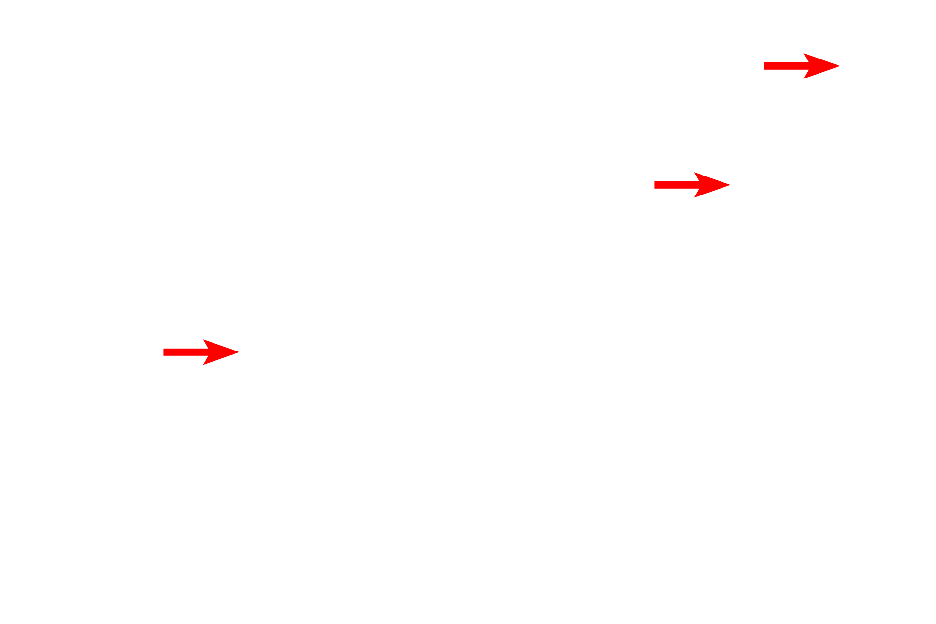 Diamond knife > <p>For routine electron microscopy, the knife is an industrial diamond that has been sharpened to an extremely fine edge. The knife assembly contains a water reservoir for collecting the sections.</p>
