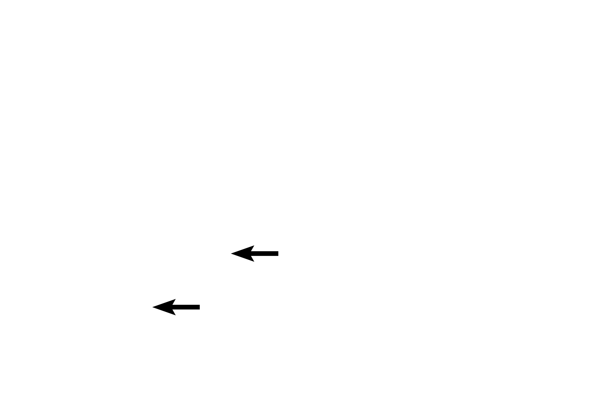  - Enzymatic activity <p>Enzyme histochemistry detects the presence of a specific enzyme in tissue, e.g., acid phosphatase, by reacting with its substrate. These methods often employ substrate analogs that produce a visible reaction product.</p>
