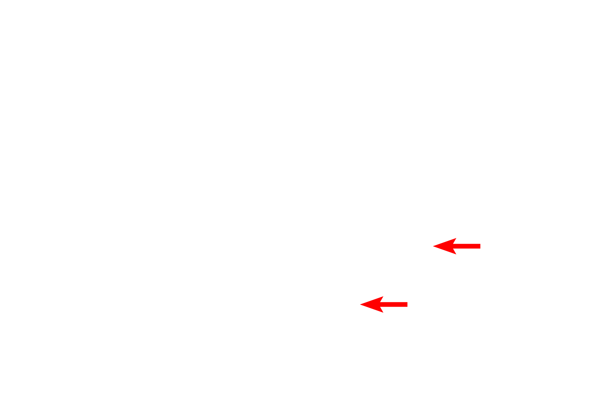 - Immunofluorescent stain  <p>Immunocytochemistry employs antibodies that specifically bind to unique proteins, e.g., actin. Sites of antibody binding are detected by fluorescent dyes that are conjugated to the antibodies.</p>
