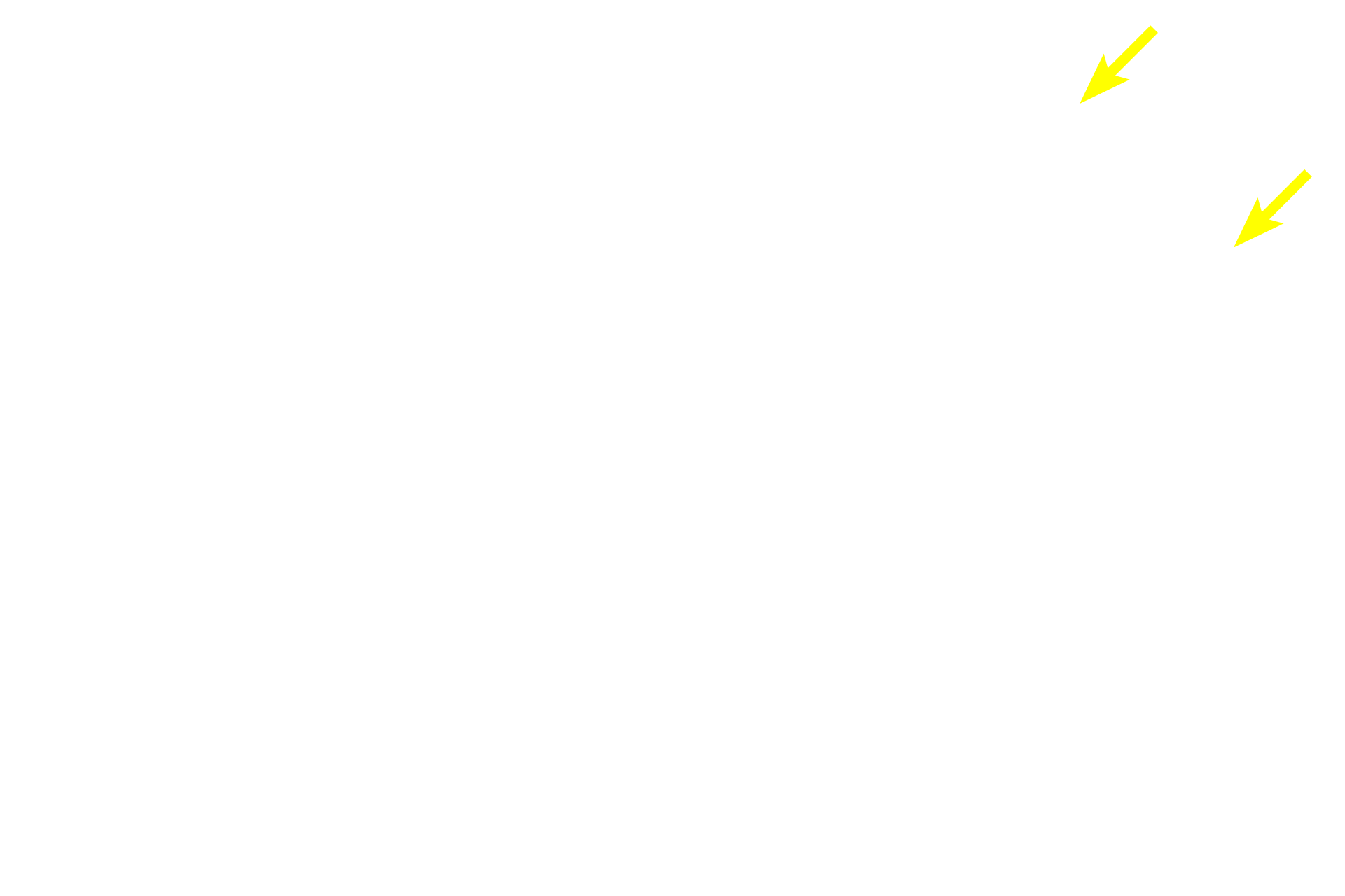  - Glycogen <p>Histochemical staining involves a chemical reaction between the tissue element and the staining reagents. This type of staining is more specific than conventional staining and is often used to detect specific chemical groups, e.g., glycogen as seen here using the periodic acid Schiff (PAS) stain.</p>

