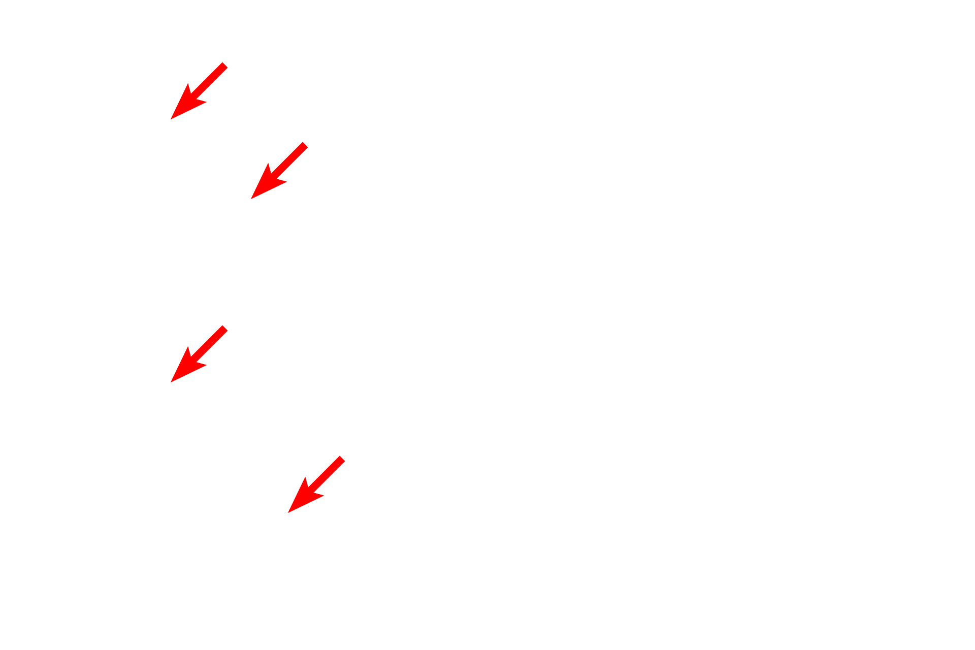  - Mitochondria <p>These images compare the appearance of mitochondria at the maximum magnification of the light microscope (1000x) (above) with that seen by the electron microscopy at 45,000x (below).  In the electron micrograph, the mitochondria are larger, but importantly, because of the higher resolving power of the electron microscope, they are visible as individual structures (even within clumps) and their internal structure is revealed.  </p>

