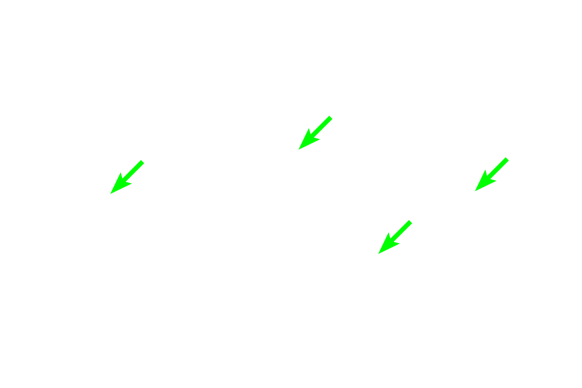 Mucosa <p>A mucosal membrane (mucosa) lines the lumen of organ systems that open to the exterior of the body (digestive, respiratory and genitourinary).  Mucosae are the most highly variable type of membrane, reflecting the diverse functions of the organs in which they are located.  A mucosa typically consists of an epithelium, a connective tissue (lamina propria), and a layer of smooth muscle (muscularis mucosae).  A mucous membrane is so named because mucus-producing glands frequently secrete onto its surface, providing lubrication.  This image shows a section of the small intestine.  100x</p>
