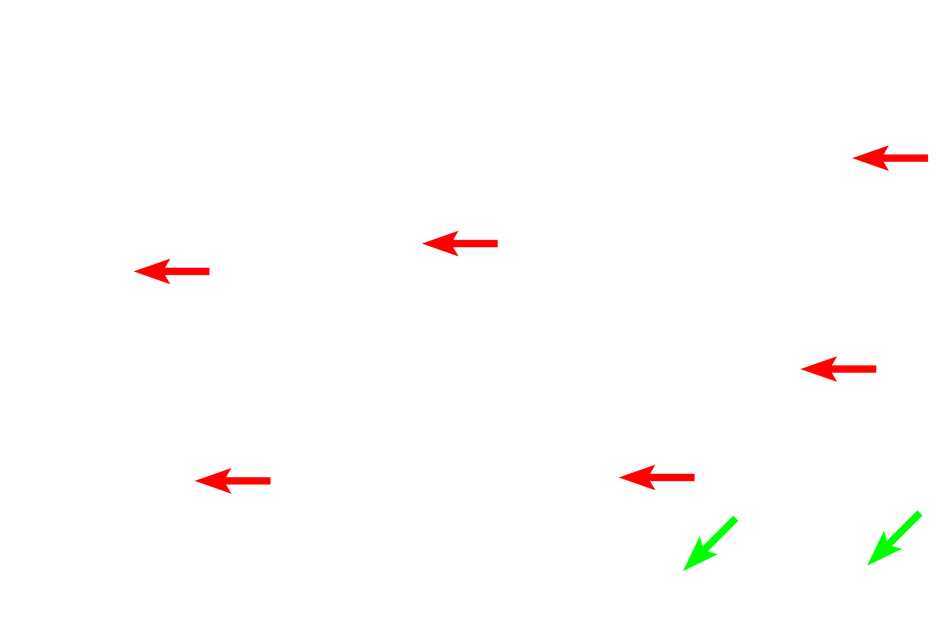 Stroma > <p>The stroma of an organ is composed of connective tissues both loose (red arrows) and dense (green arrows).</p>
