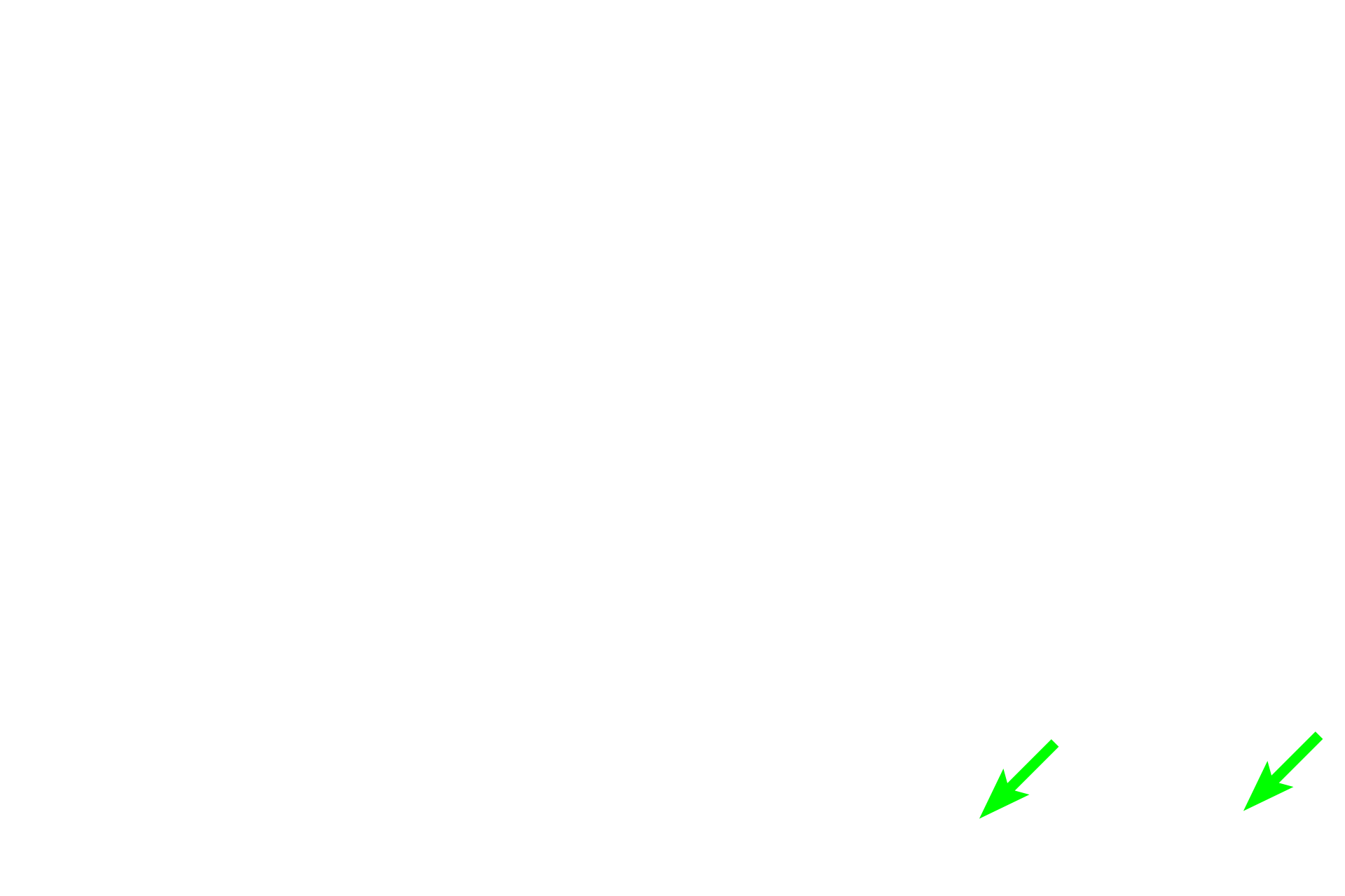  - Dense connective tissue > <p>The stroma also provides more robust structural support for organs wall.  In these areas, thick collagen fibers of the dense connective tissue predominate.  This section is stained by the trichrome method which demonstrates the stroma of an organ by labeling the connective tissue bluish green.</p>
