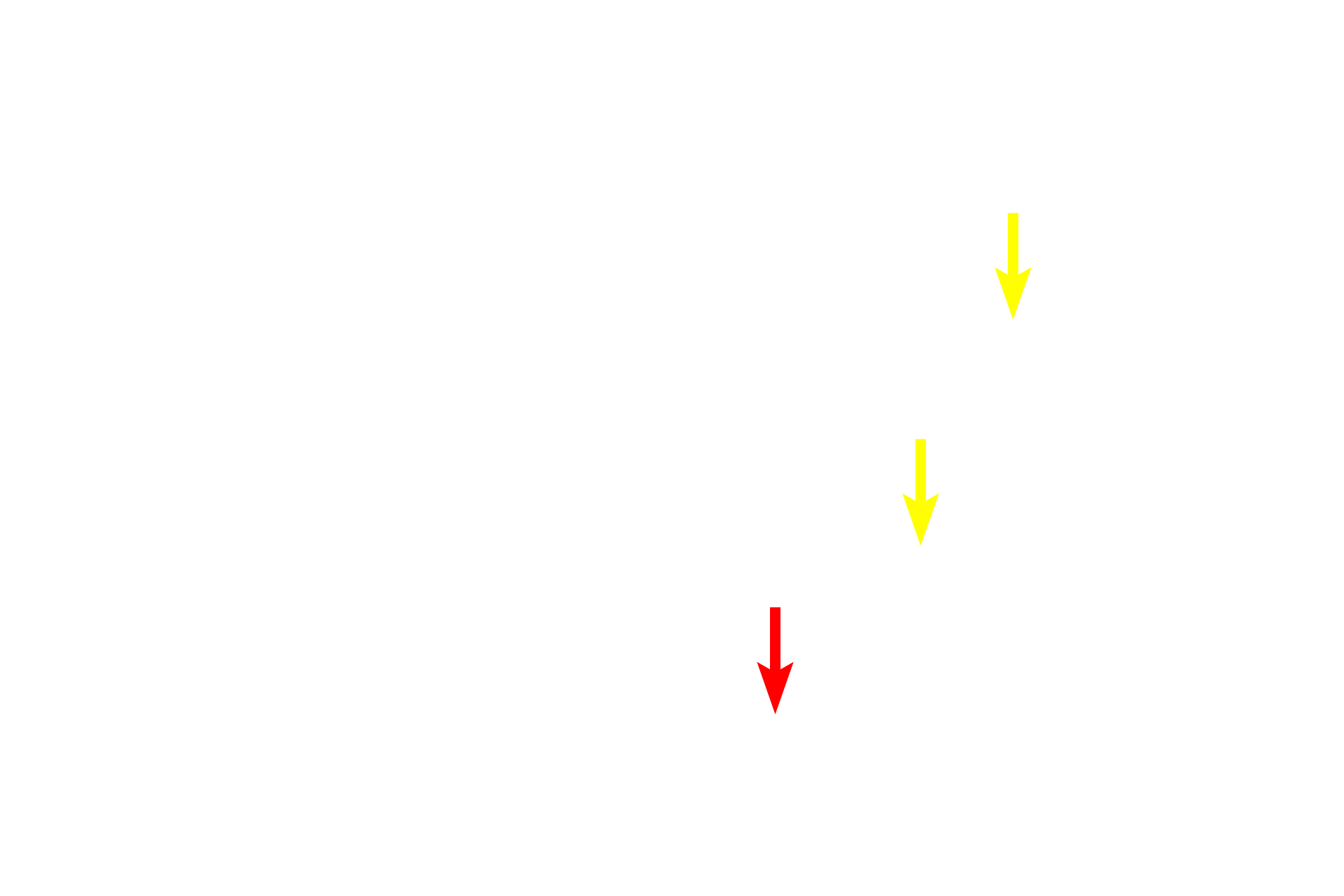 Blood vessels <p>These images compare the structure of a lymph node stained by the silver method (left) and H&E (right).  The stroma of a lymph node is composed of reticular fibers which are specifically stained by the silver technique.  The parenchymal tissue is revealed with the H&E stain. The parenchymal cells, mostly lymphocytes, are suspended along a meshwork of reticular fibers, that provide delicate support while allowing for cell migration and lymph passage.  The reticular fibers are not differentiated by the H&E stain.  100x.</p>
