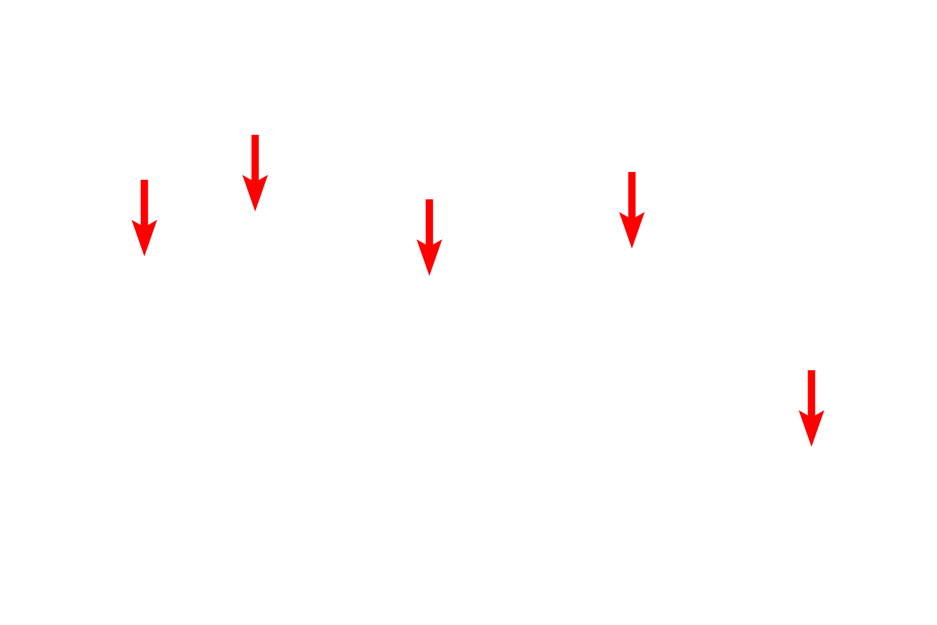  - Melansomes <p>This electron micrograph shows the stratum basale, consisting of a single layer of columnar cells.  The basal surfaces of these keratinocytes are highly folded for anchorage to the basal lamina.  The cells contain tonofibrils composed of tonofilaments (keratin filaments), which are mostly oriented perpendicular to the basal lamina.  4000x</p>
