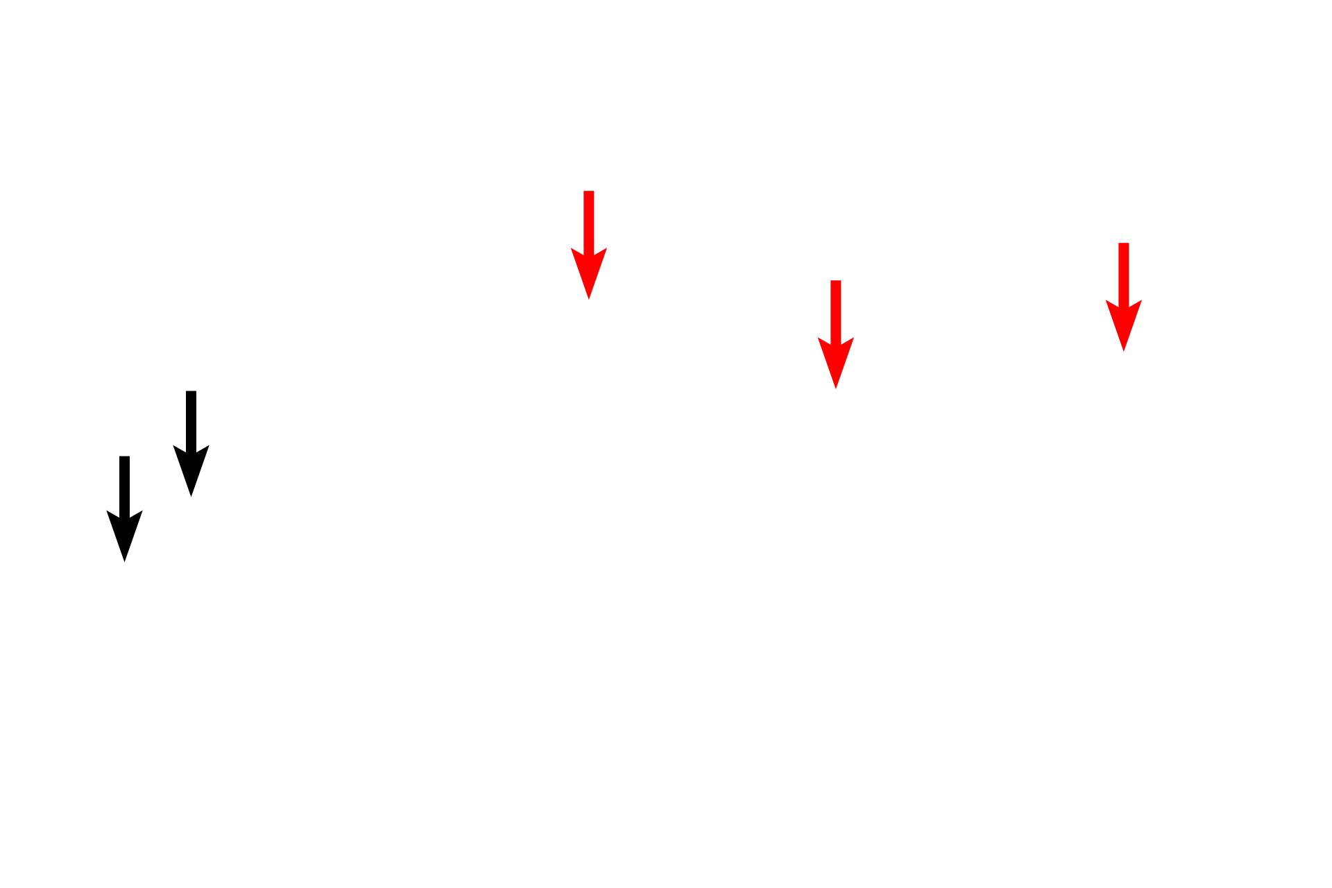  - Melanosomes <p>These images compare the light and electron microscopic appearance of cells in the stratum basale.  The large bundles of keratin filaments (tonofilaments) are clearly visible at the light and electron microscopic level.  The keratin filaments insert into desmosomes on the lateral and apical surfaces of the cell.  They also insert into hemidesmosomes along the basal surface, adjacent to the basal lamina.  1000x, 4000x  </p>
