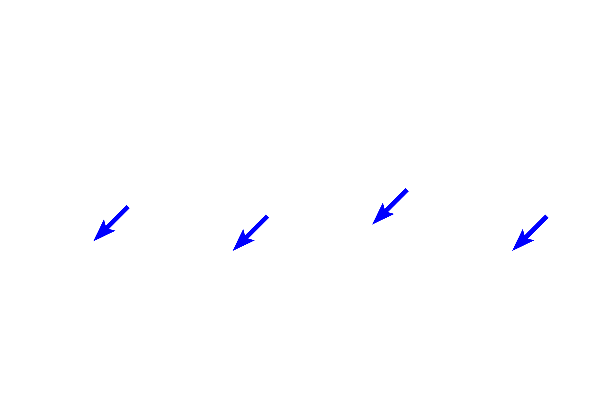 Stratum basale <p>These images compare light (l) and dark (r) skin.  In dark skin, the cells of the stratum basale contain much more melanin pigment than those in light skin.  While the amount of melanin varies between skin types, the number of melanocytes is similar.  700x</p>
