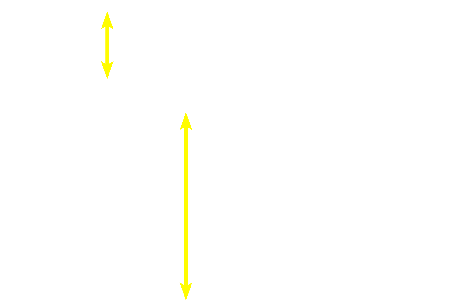 Fascicles <p>These longitudinal sections show fascicles of peripheral nerves at low (l) and high (r) magnifications.  Each fascicle is immediately surrounded by a compact perineurium and epineurium.  The epineurium between fascicles appears more loosely organized.  The perineurium is distinctly more basophilic than the more collagenous, eosinophilic epineurium.  Within the nerve, individual myelinated axons are surrounded by an endoneurium.    100x, 800x</p>
