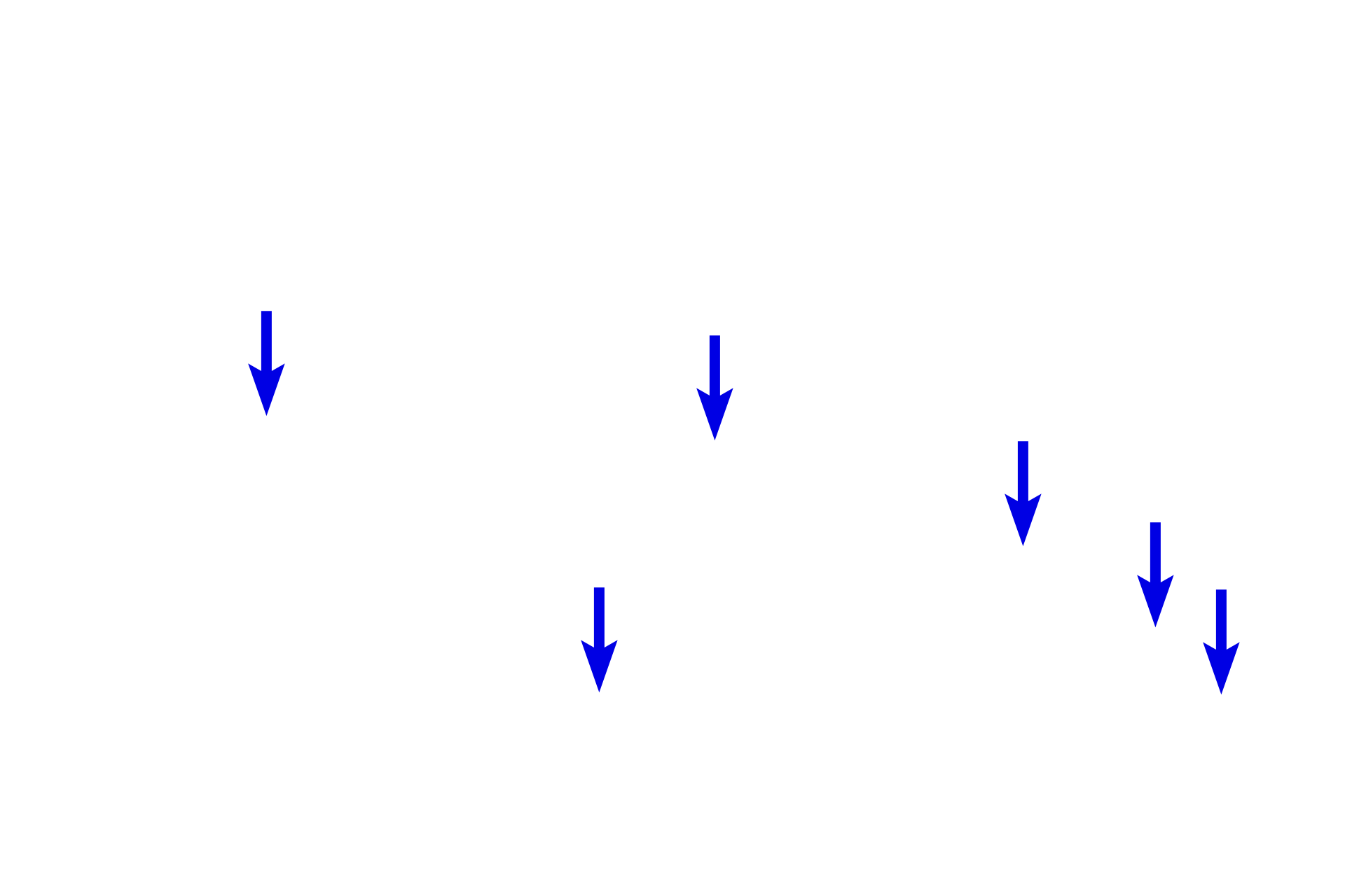 Axons <p>These longitudinal sections show fascicles of peripheral nerves at low (l) and high (r) magnifications.  Each fascicle is immediately surrounded by a compact perineurium and epineurium.  The epineurium between fascicles appears more loosely organized.  The perineurium is distinctly more basophilic than the more collagenous, eosinophilic epineurium.  Within the nerve, individual myelinated axons are surrounded by an endoneurium.  100x, 800x</p>
