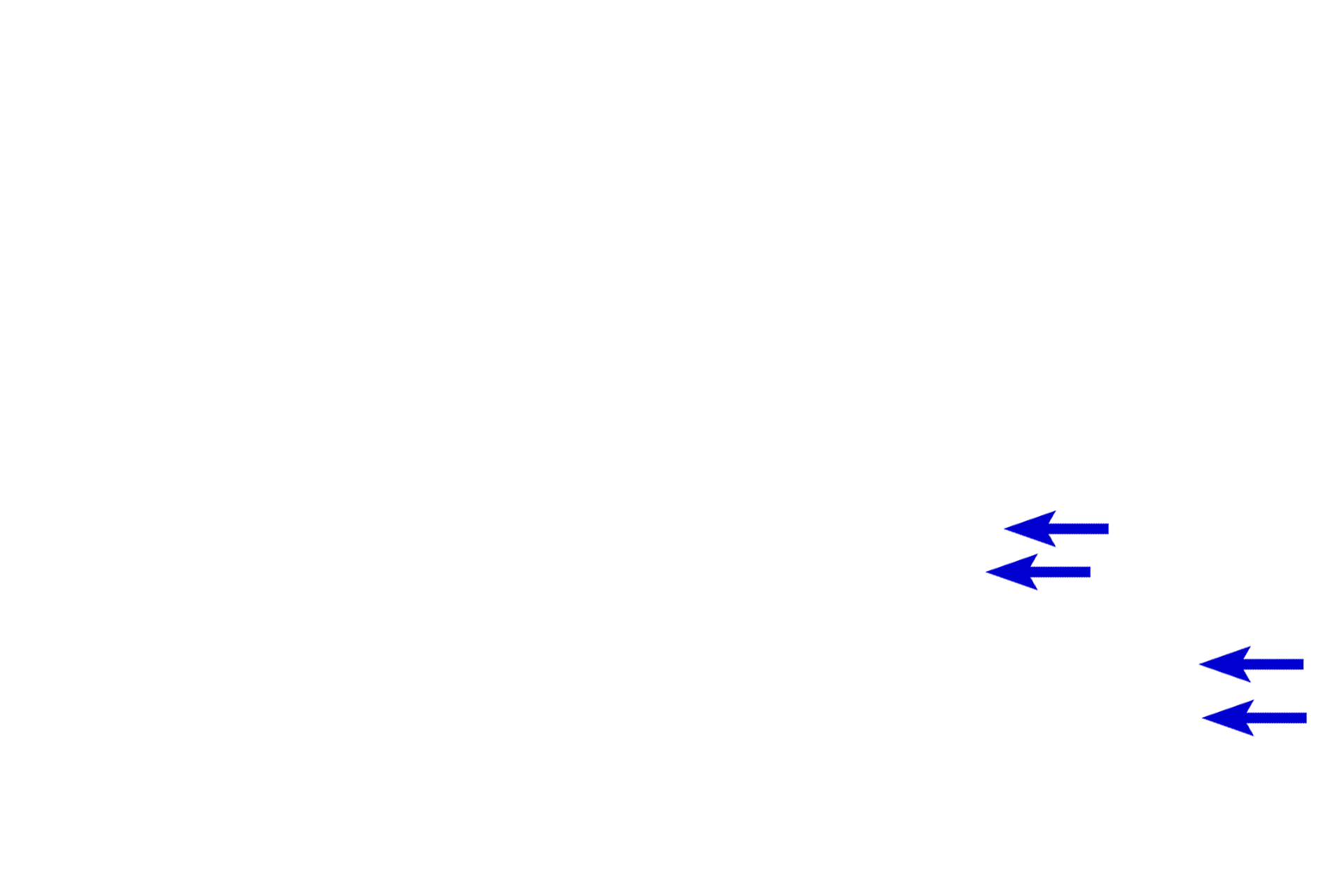 Myelin sheaths <p>These longitudinal sections show fascicles of peripheral nerves at low (l) and high (r) magnifications.  Each fascicle is immediately surrounded by a compact perineurium and epineurium.  The epineurium between fascicles appears more loosely organized.  The perineurium is distinctly more basophilic than the more collagenous, eosinophilic epineurium.  Within the nerve, individual myelinated axons are surrounded by an endoneurium.  100x, 800x</p>
