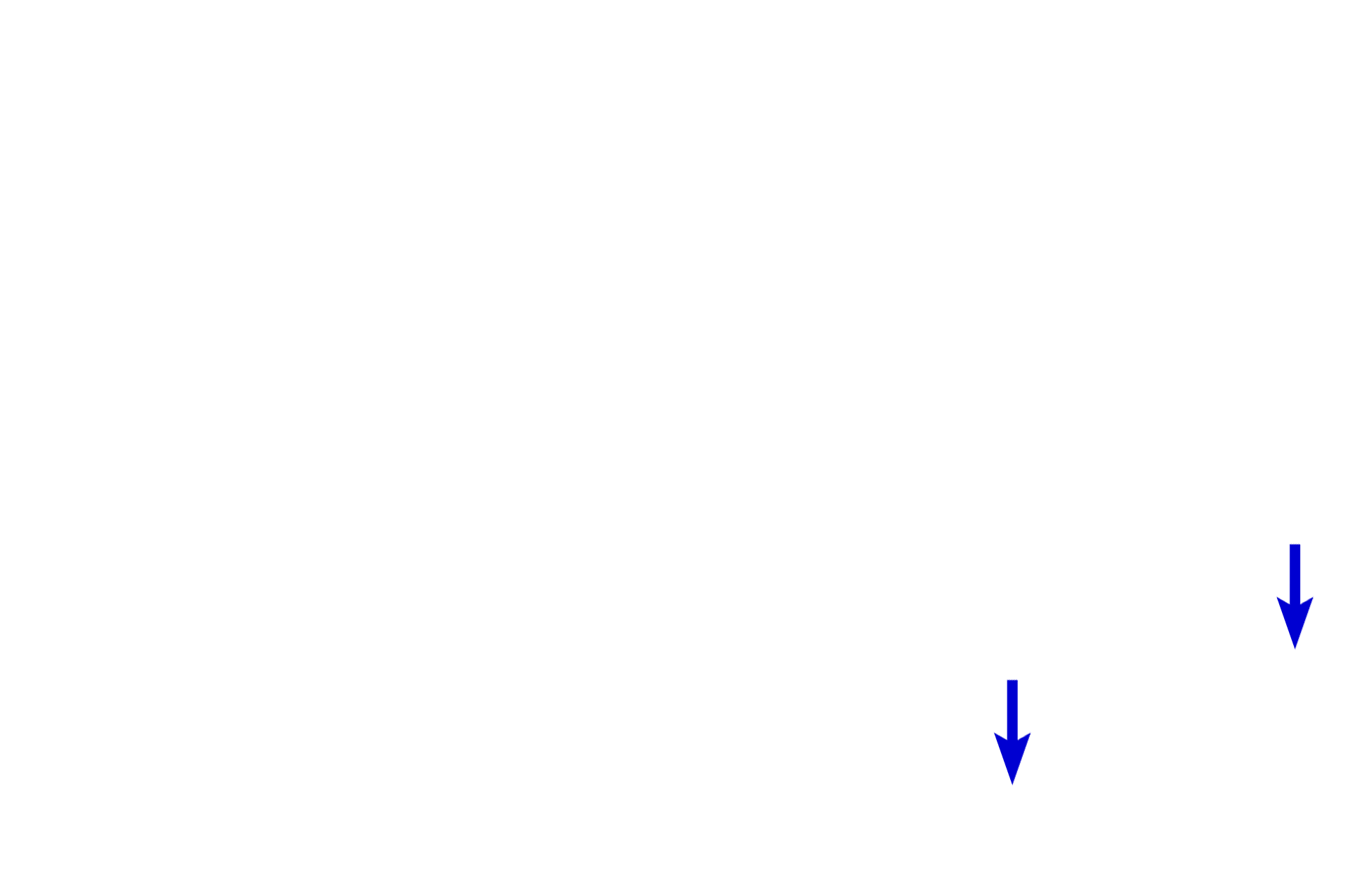 Schwann cell nuclei <p>These longitudinal sections show fascicles of peripheral nerves at low (l) and high (r) magnifications.  Each fascicle is immediately surrounded by a compact perineurium and epineurium.  The epineurium between fascicles appears more loosely organized.  The perineurium is distinctly more basophilic than the more collagenous, eosinophilic epineurium.  Within the nerve, individual myelinated axons are surrounded by an endoneurium.  100x, 800x</p>
