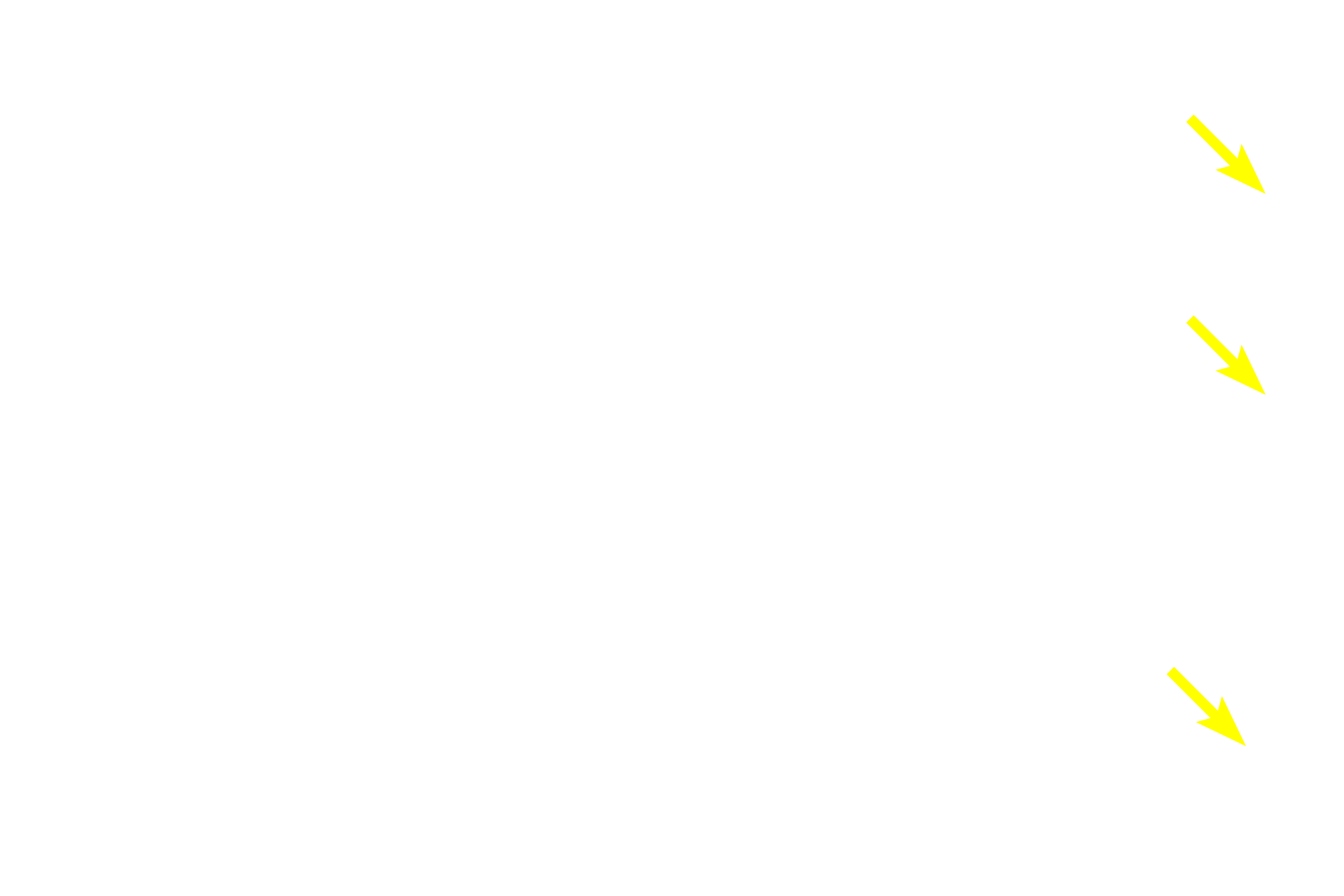  - Lining epithelium >  <p>Epithelial cells can be arranged in single or multiple layers, forming membranes that line or cover all body surfaces. For example, a multilayered epithelium forms the outer layer of the skin as well as the inner surface of the oral cavity and esophagus.  Single-layered epithelia line most internal surfaces, such as blood vessels and body cavities.</p>
