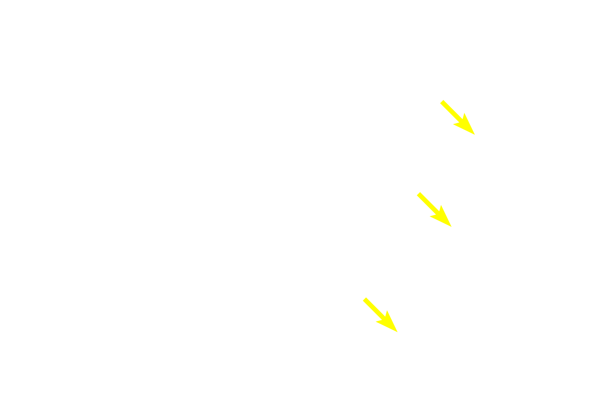  - Glandular epithelium > <p>Glands consist of epithelial cells modified to secrete a product. Exocrine glands (shown here) are attached to a lining epithelium and secrete onto its surface.  Endocrine glands lose their attachment with an epithelium and secrete into the blood stream.  Glands may be microscopic like these gastric glands or large, macroscopic glands such as salivary glands.</p>
