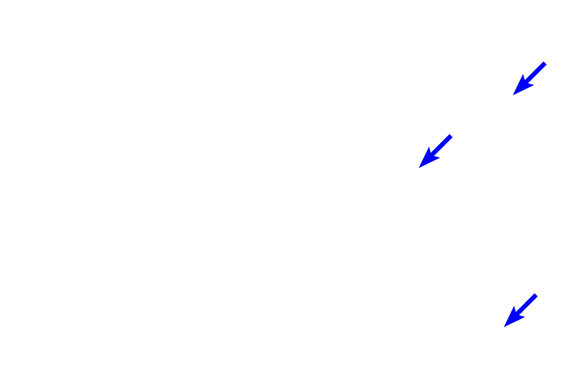  - Loose connective tissue <p>Connective tissue proper is one of the major categories of connective tissues, along with cartilage, bone and blood.  Connective tissue proper, also called fibrous connective tissue, is widely distributed throughout organs and is subdivided into two major categories, loose connective tissue and dense connective tissue.  These designations are based on the arrangement and size of the collagen fibers and the number and types of cells present.</p>
