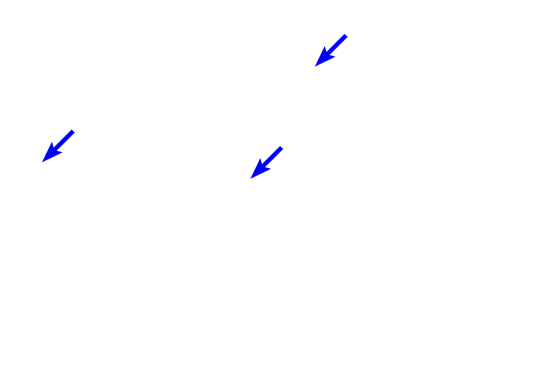  - Dense connective tissue <p>Connective tissue proper is one of the major categories of connective tissues, along with cartilage, bone and blood.  Connective tissue proper, also called fibrous connective tissue, is widely distributed throughout organs and is subdivided into two major categories, loose connective tissue and dense connective tissue.  These designations are based on the arrangement and size of the collagen fibers and the number and types of cells present.</p>
