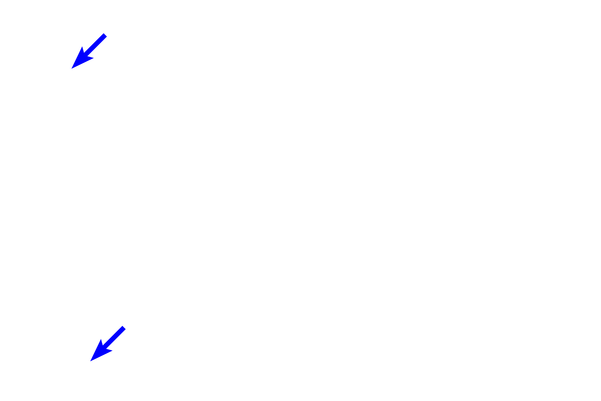 Nervous tissue > <p>Nervous tissue is composed of nerve cells (neurons) and their supporting cells. Most nervous tissue is concentrated in the brain and spinal cord, with nerves extending into the periphery.  The nervous tissue indicated here regulates the contraction of smooth muscle in the wall of the stomach. </p>
